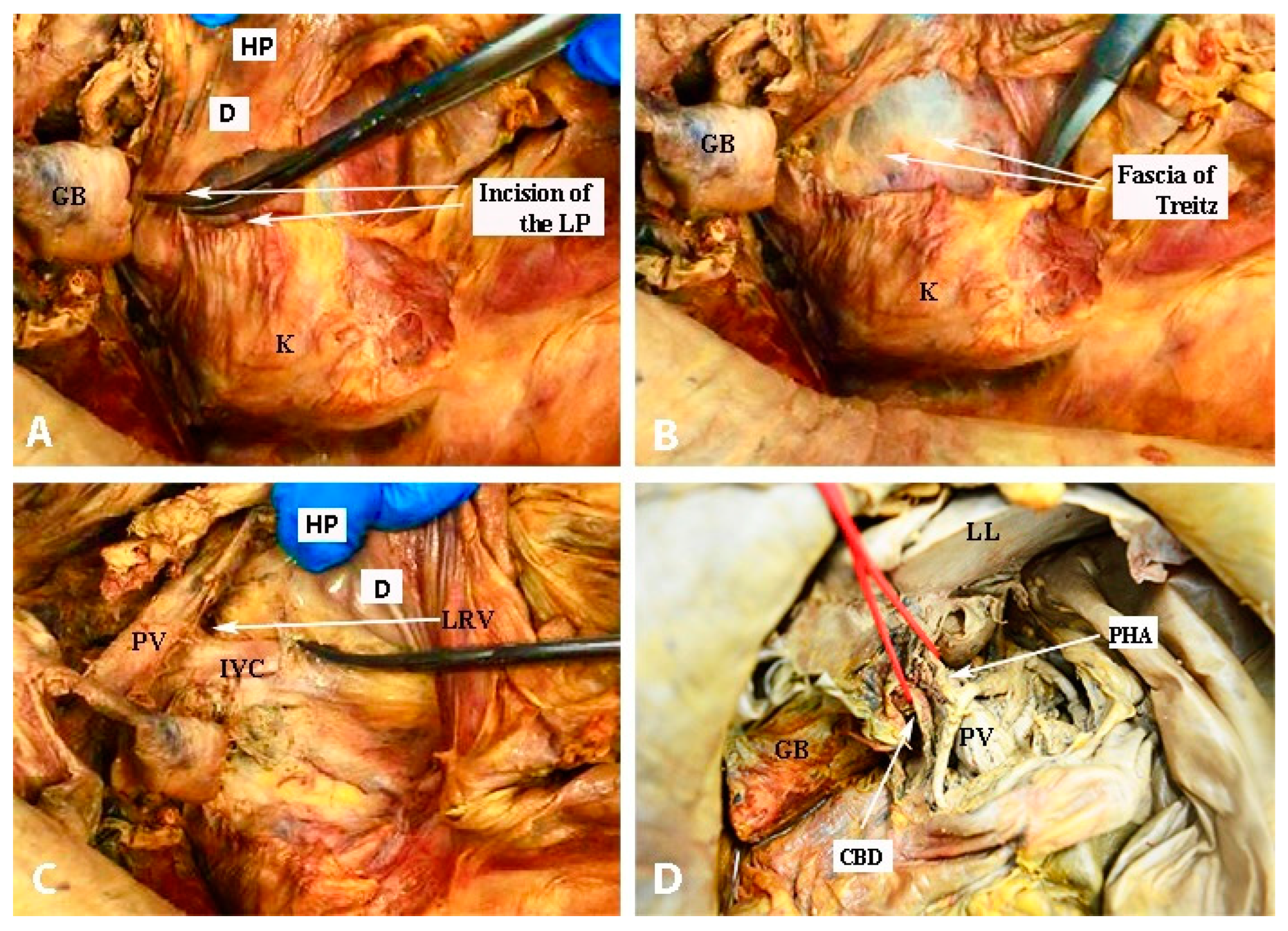 Diagnostics 13 02371 g028