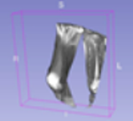 Diagnostics 13 02377 i036 Diagnostics 13 02377 i036