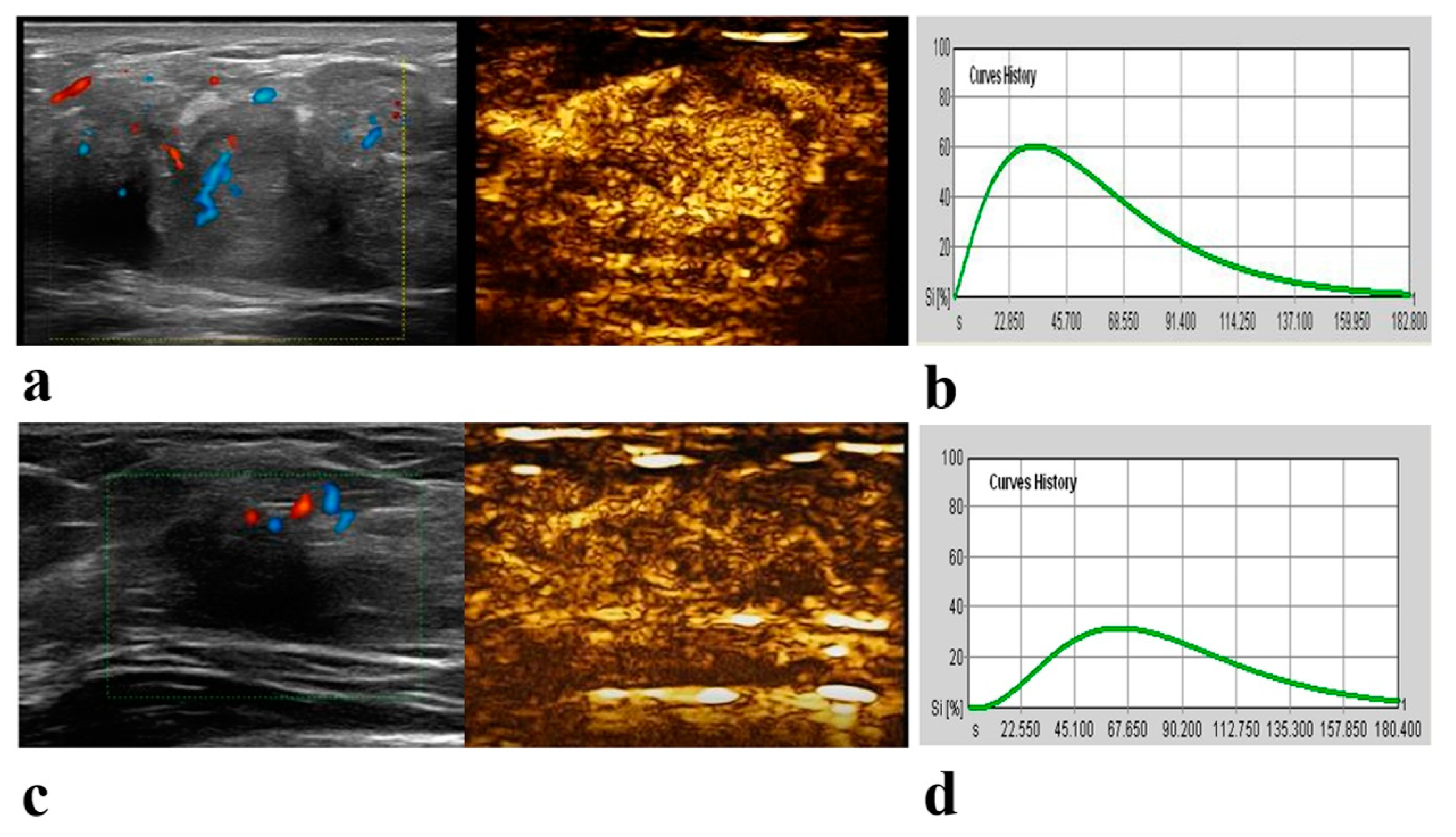Diagnostics 13 02378 g003