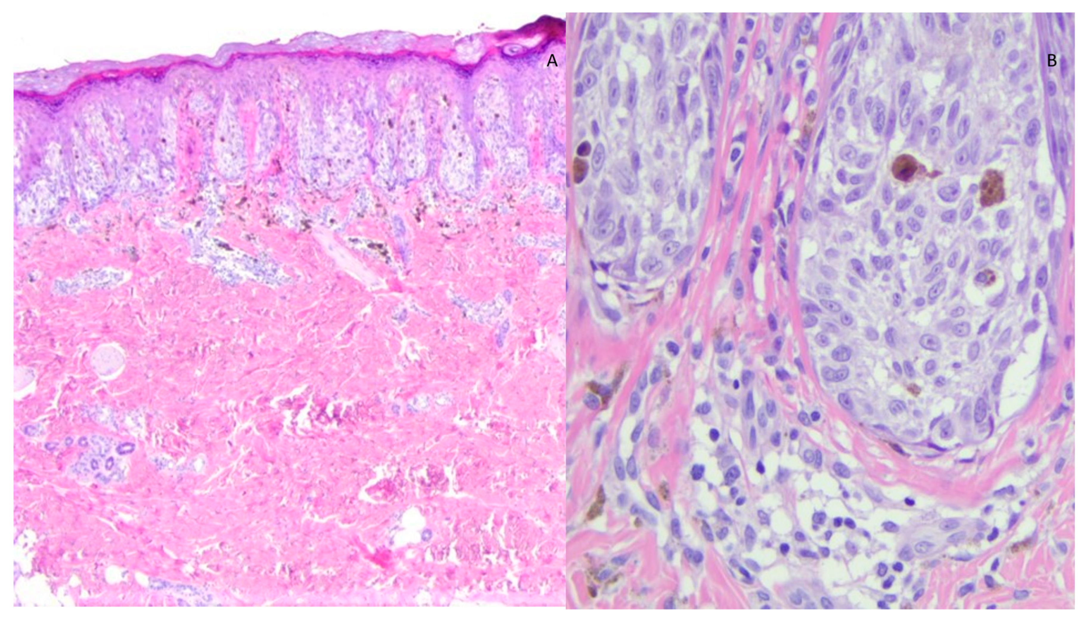 Diagnostics 13 02380 g001