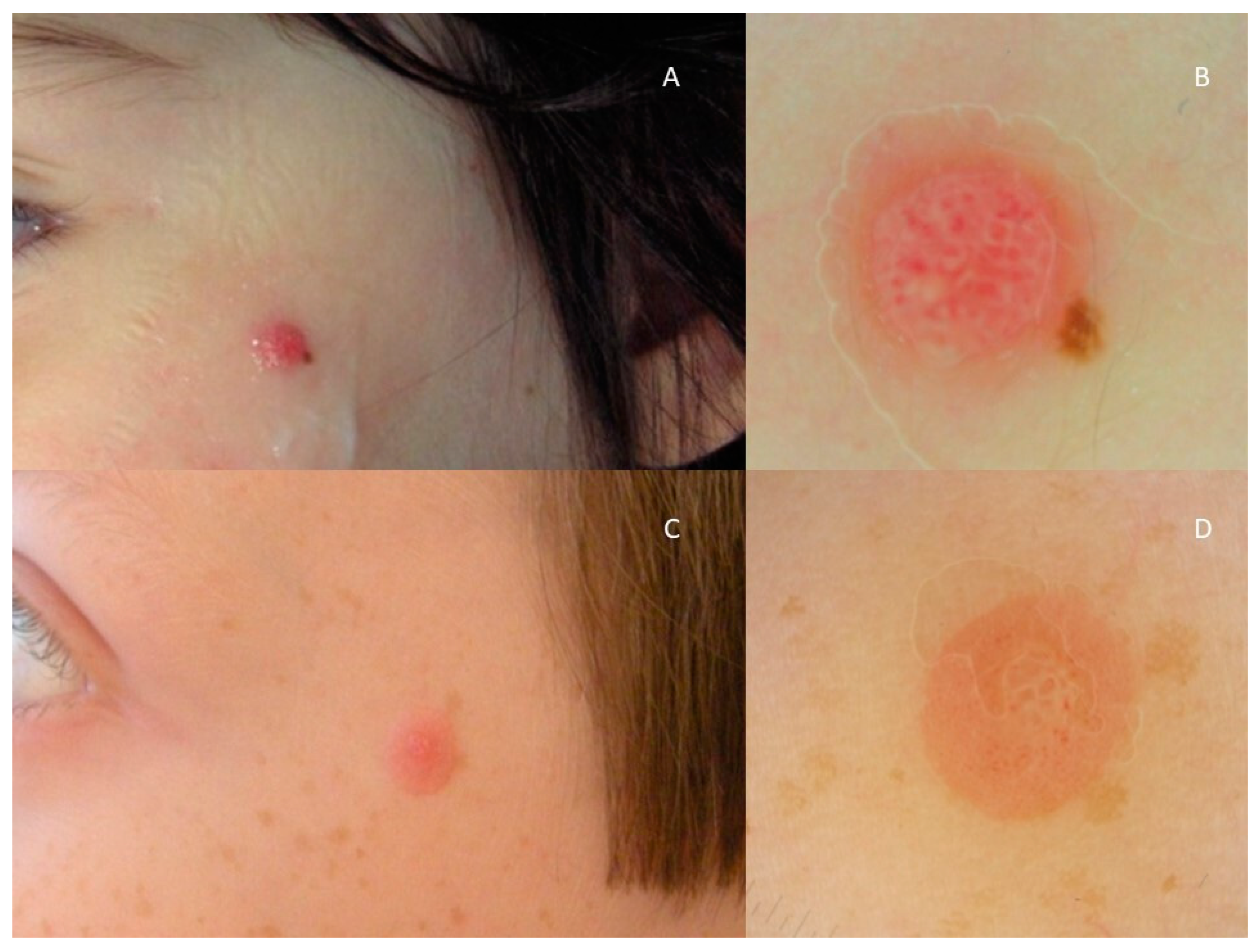 Diagnostics 13 02380 g004