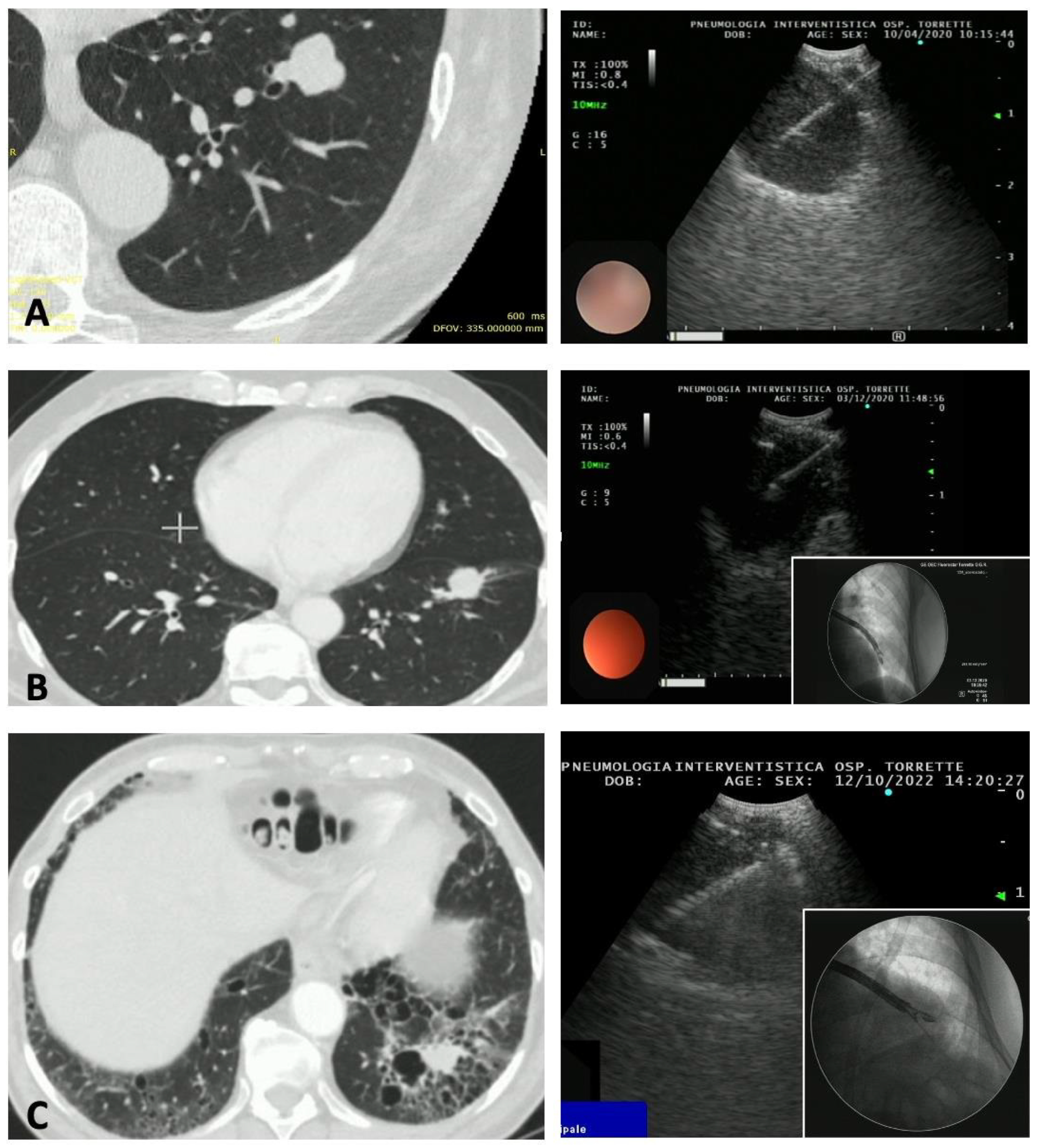 Diagnostics 13 02393 g001