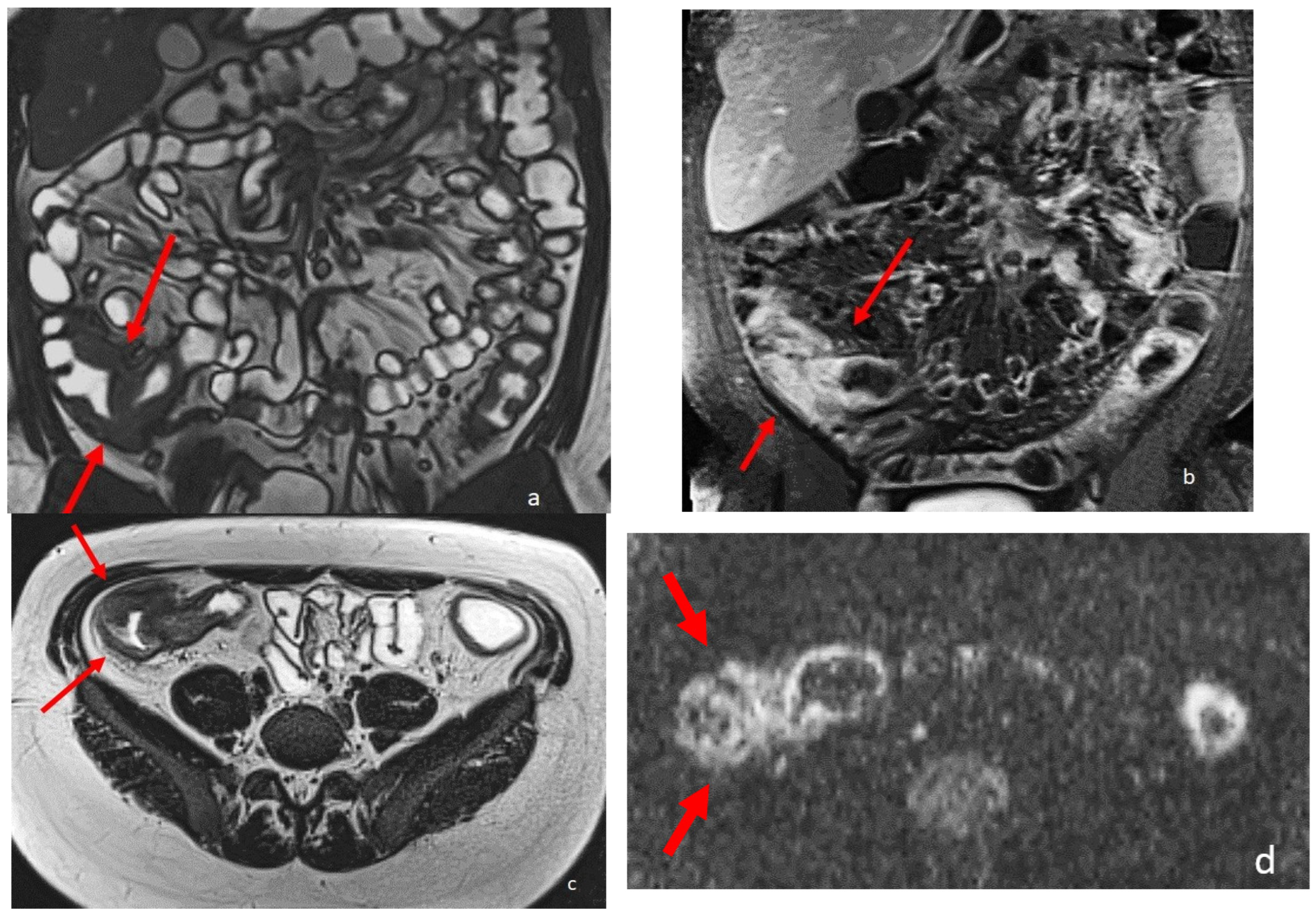 Diagnostics 13 02410 g002