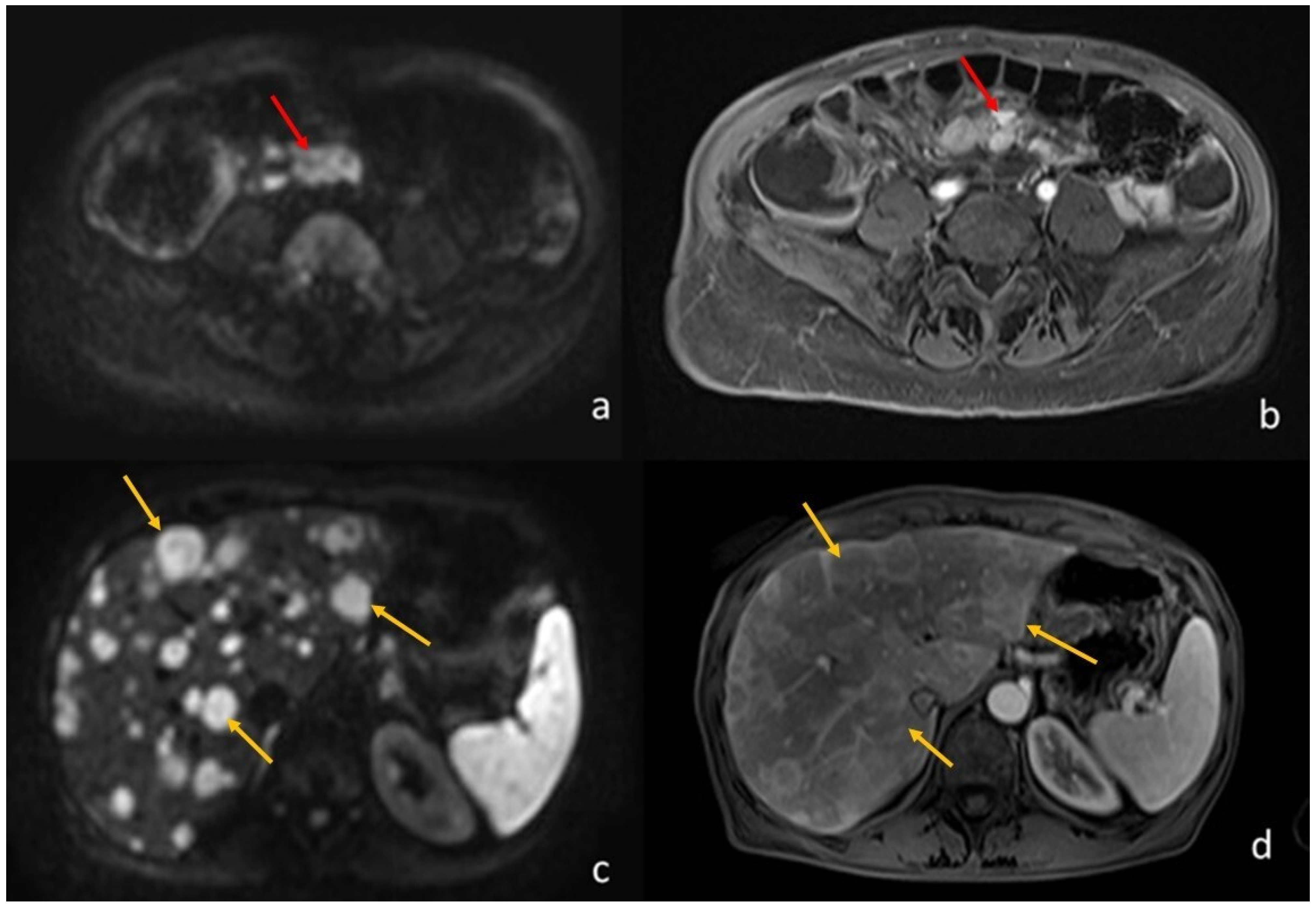 Diagnostics 13 02410 g003