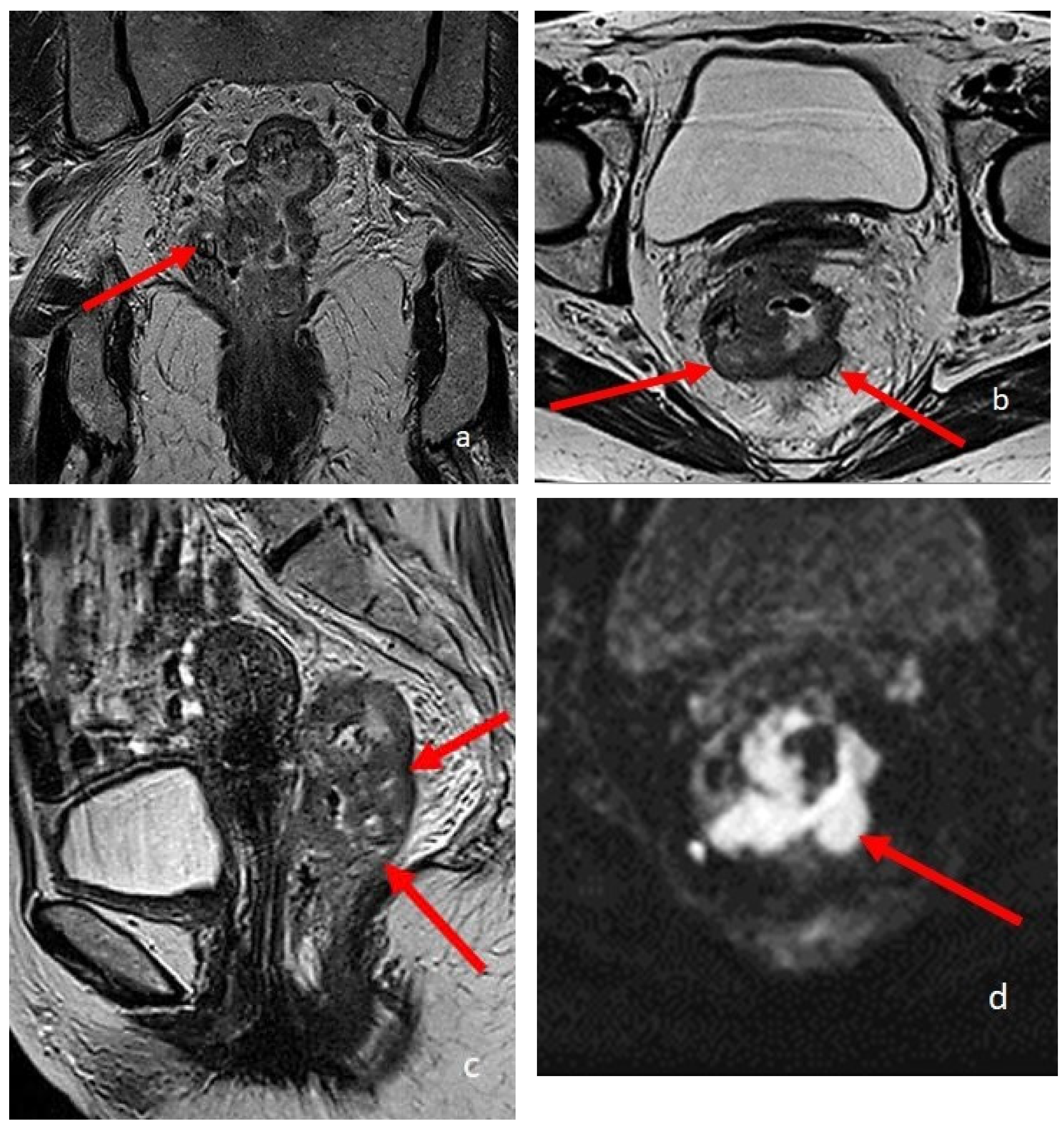Diagnostics 13 02410 g004