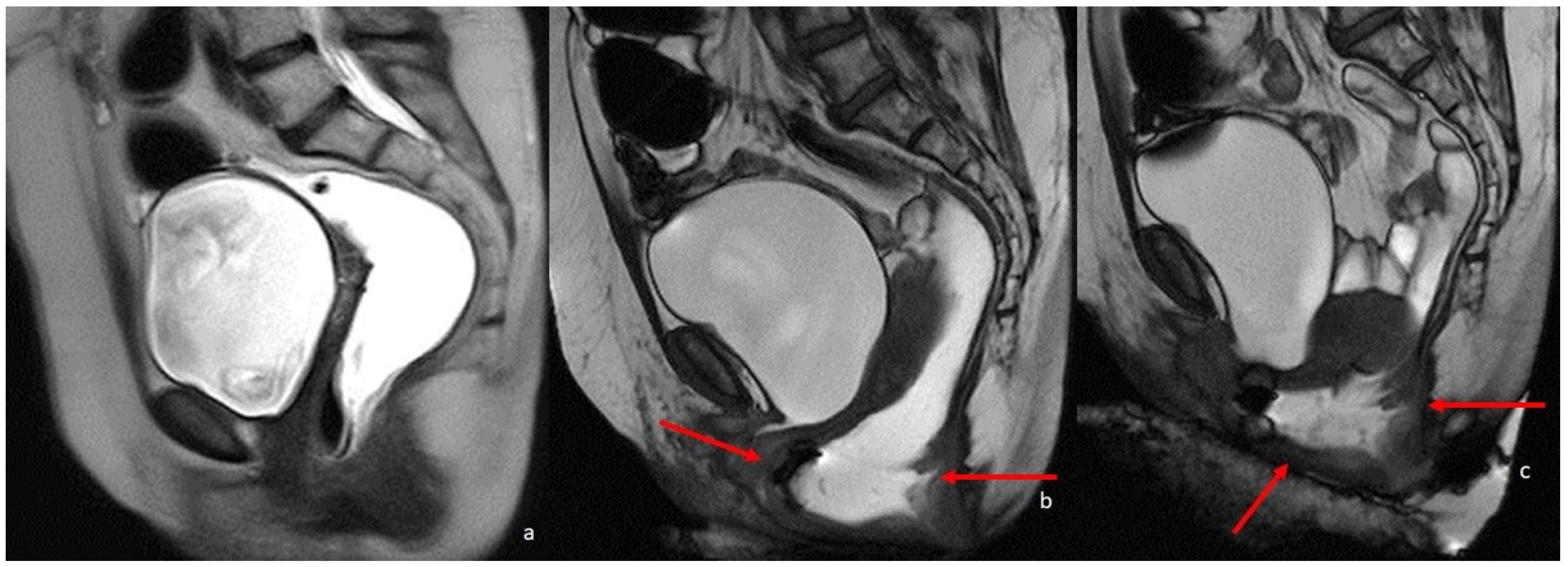 Diagnostics 13 02410 g005
