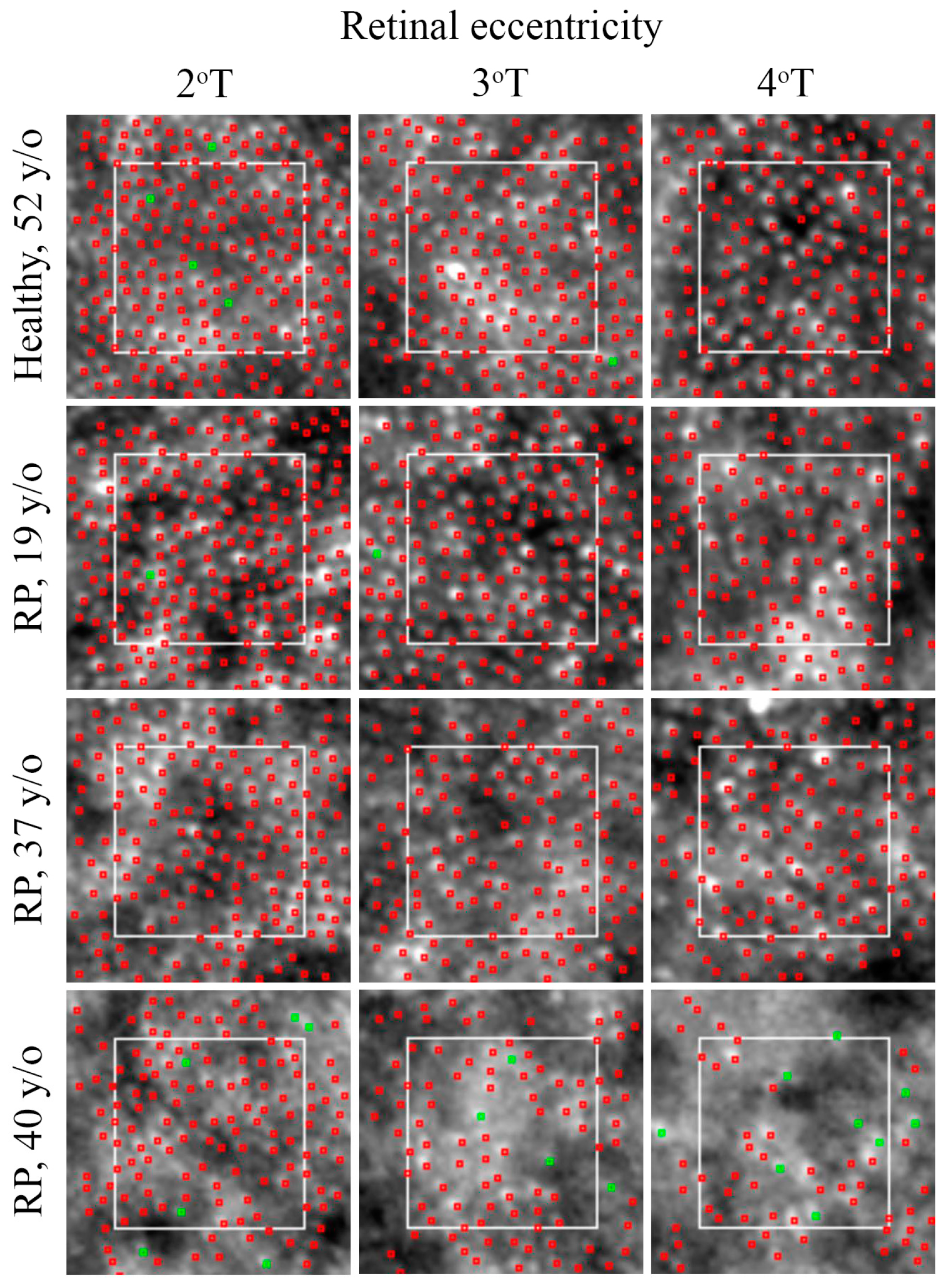 Diagnostics 13 02413 g006 Diagnostics 13 02413 g006
