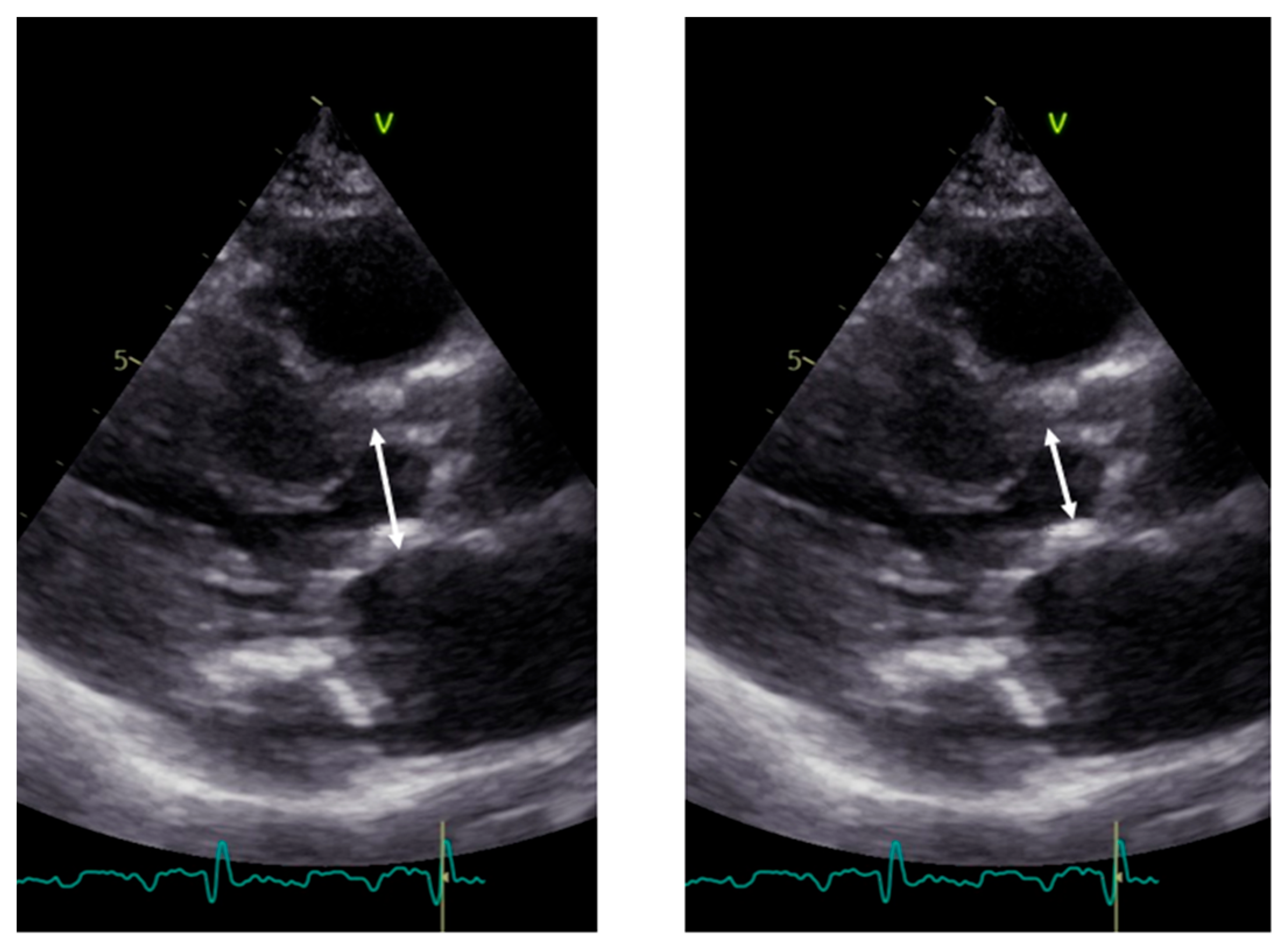 Diagnostics 13 02414 g004