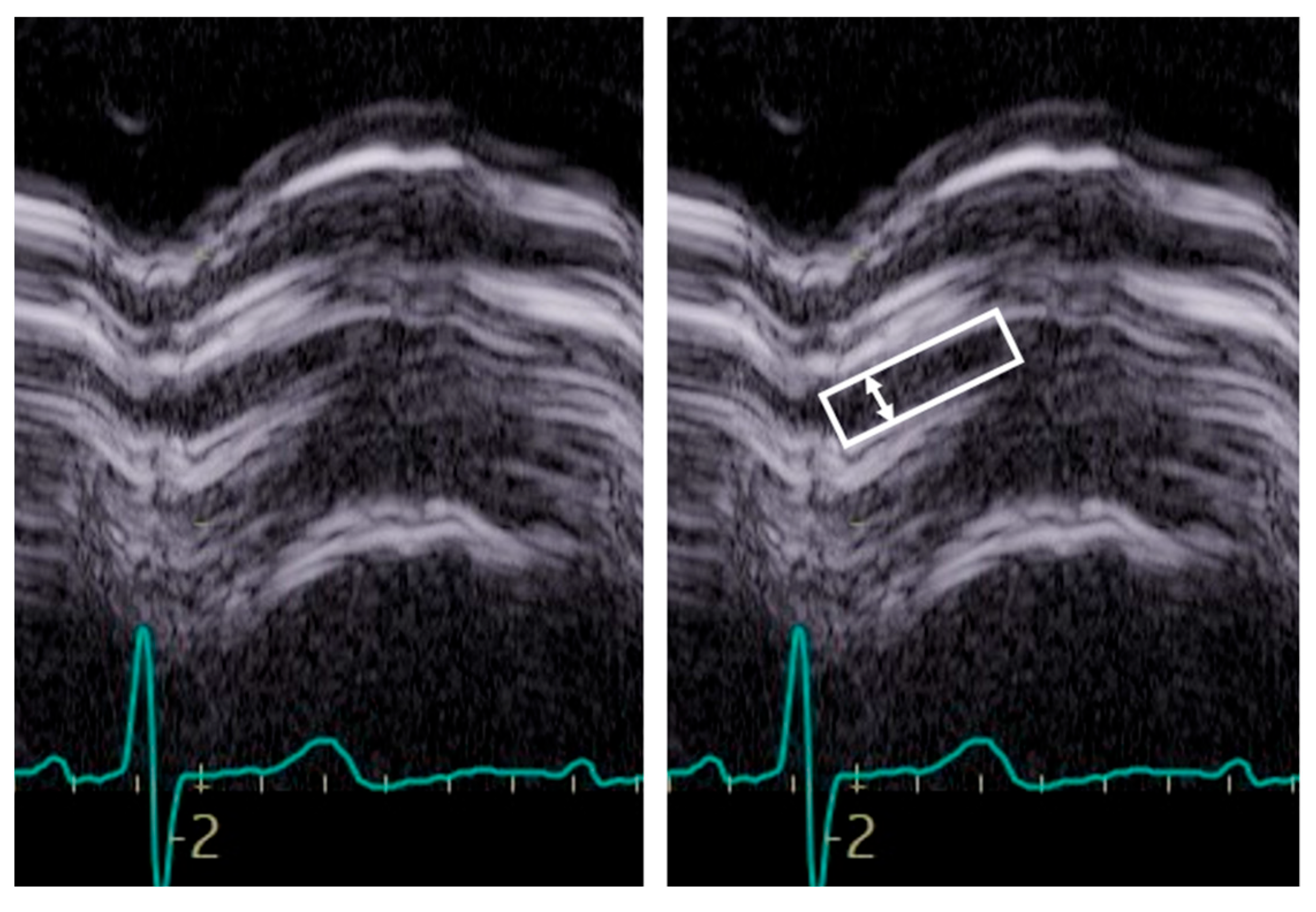 Diagnostics 13 02414 g005