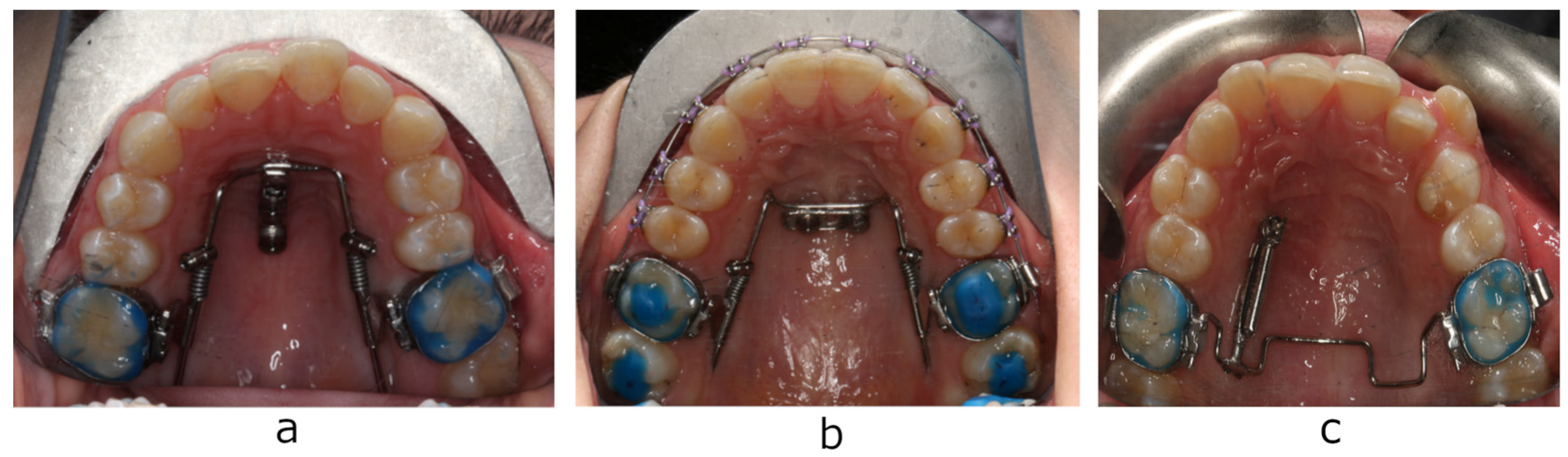 Diagnostics 13 02421 g001 Diagnostics 13 02421 g001