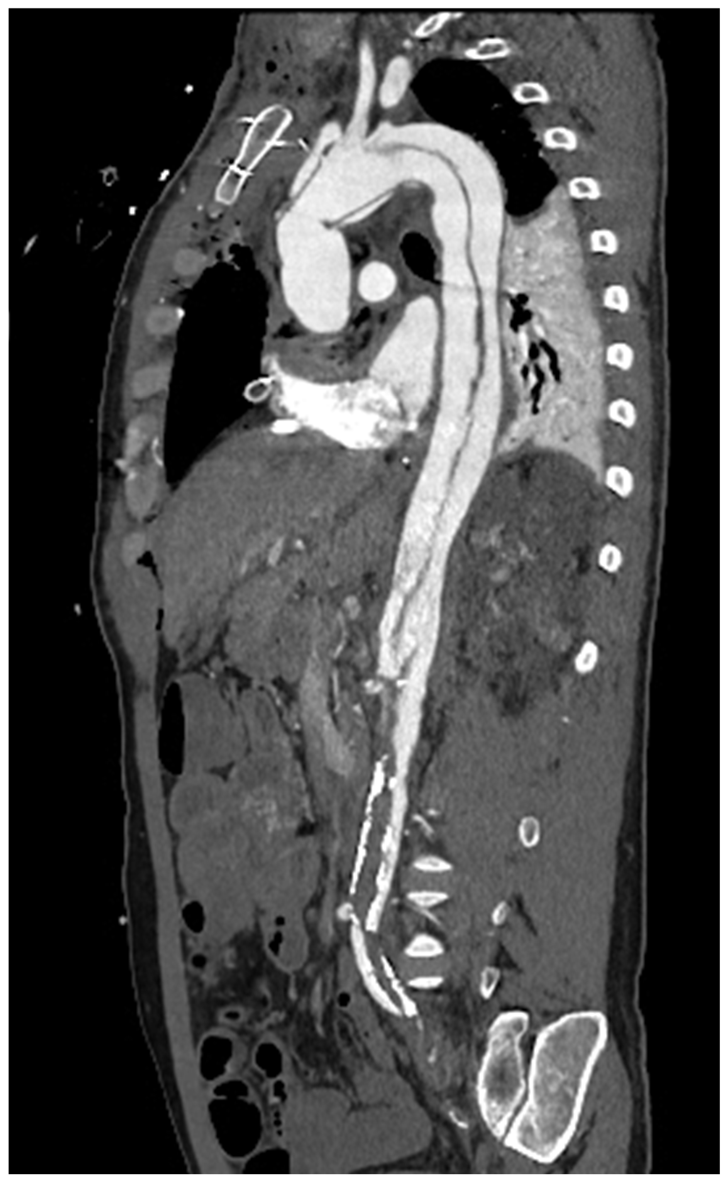 Diagnostics 13 02439 g005