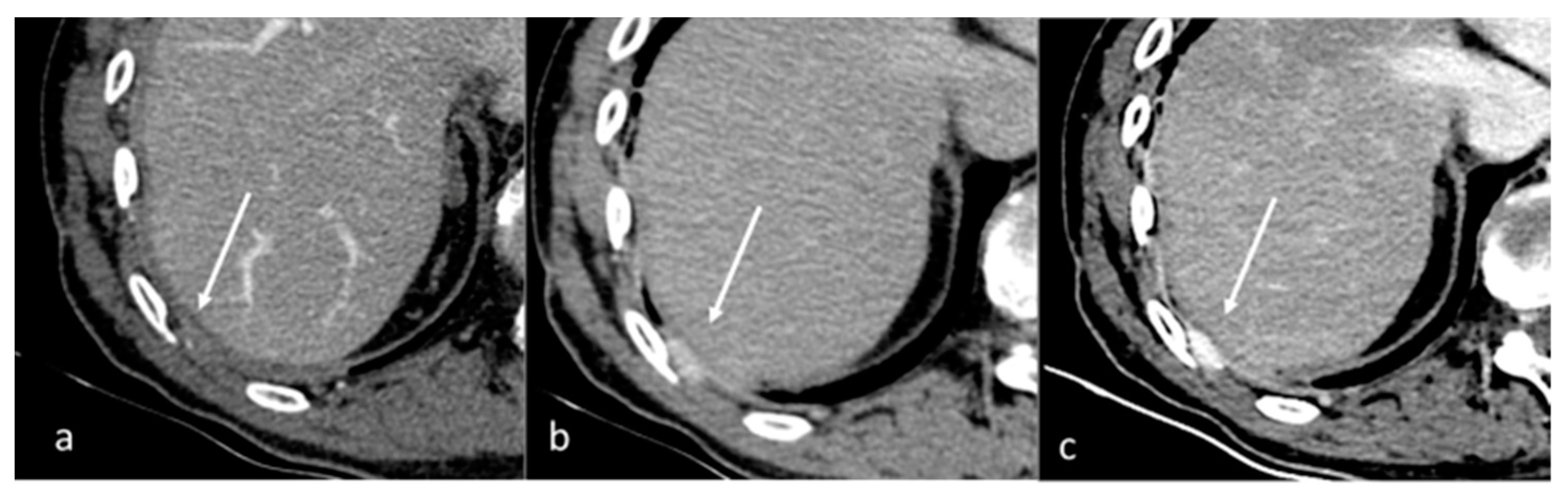 Diagnostics 13 02440 g001