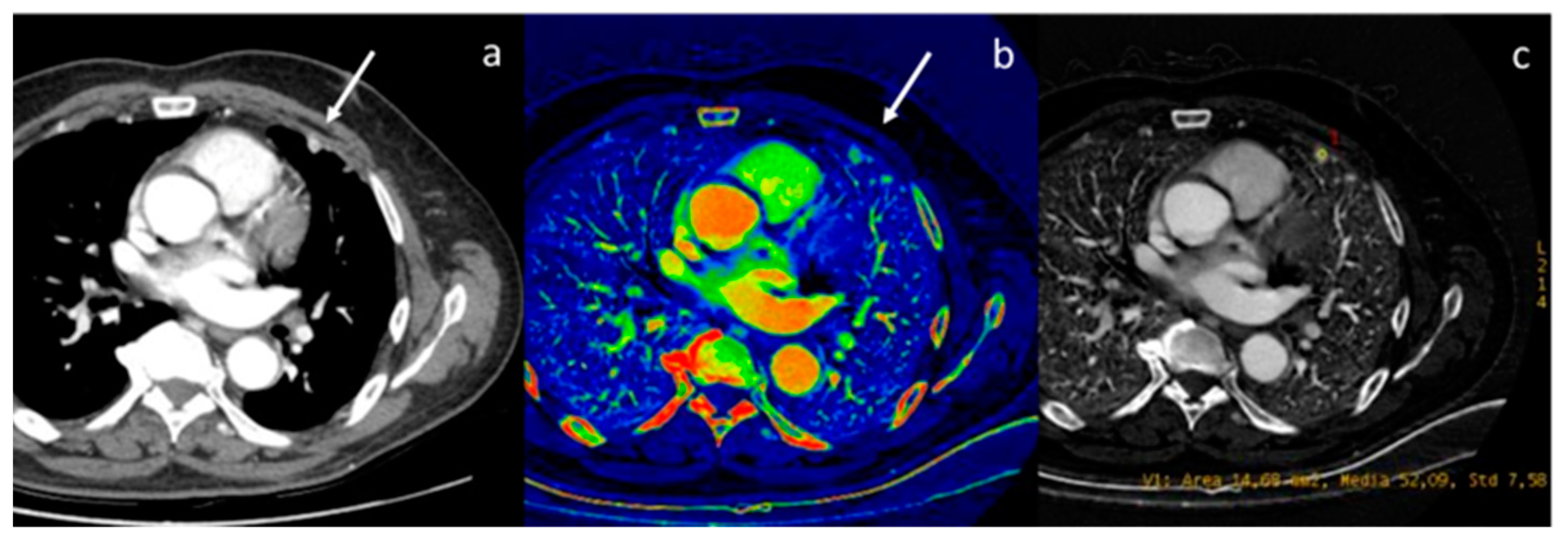 Diagnostics 13 02440 g003