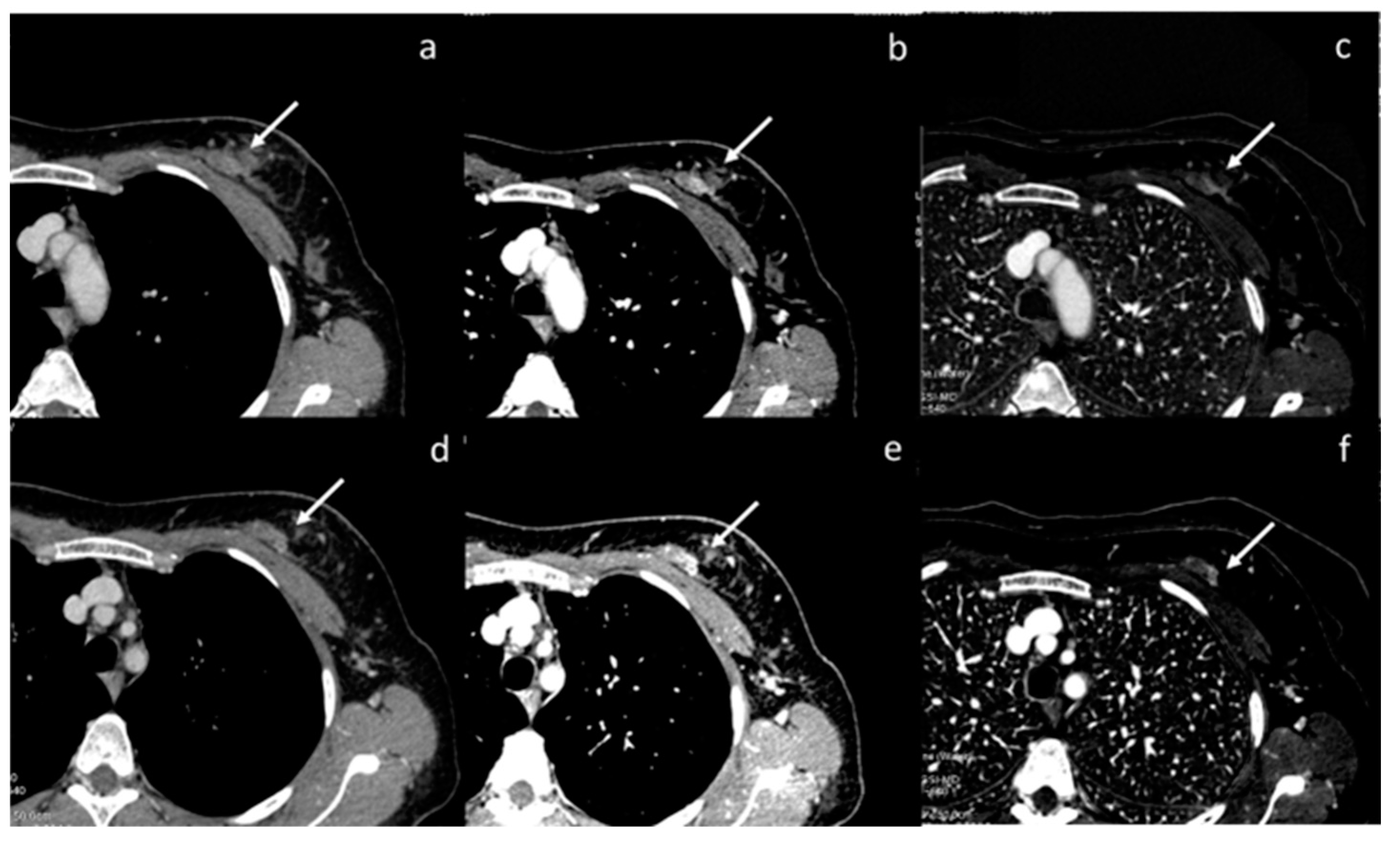 Diagnostics 13 02440 g004