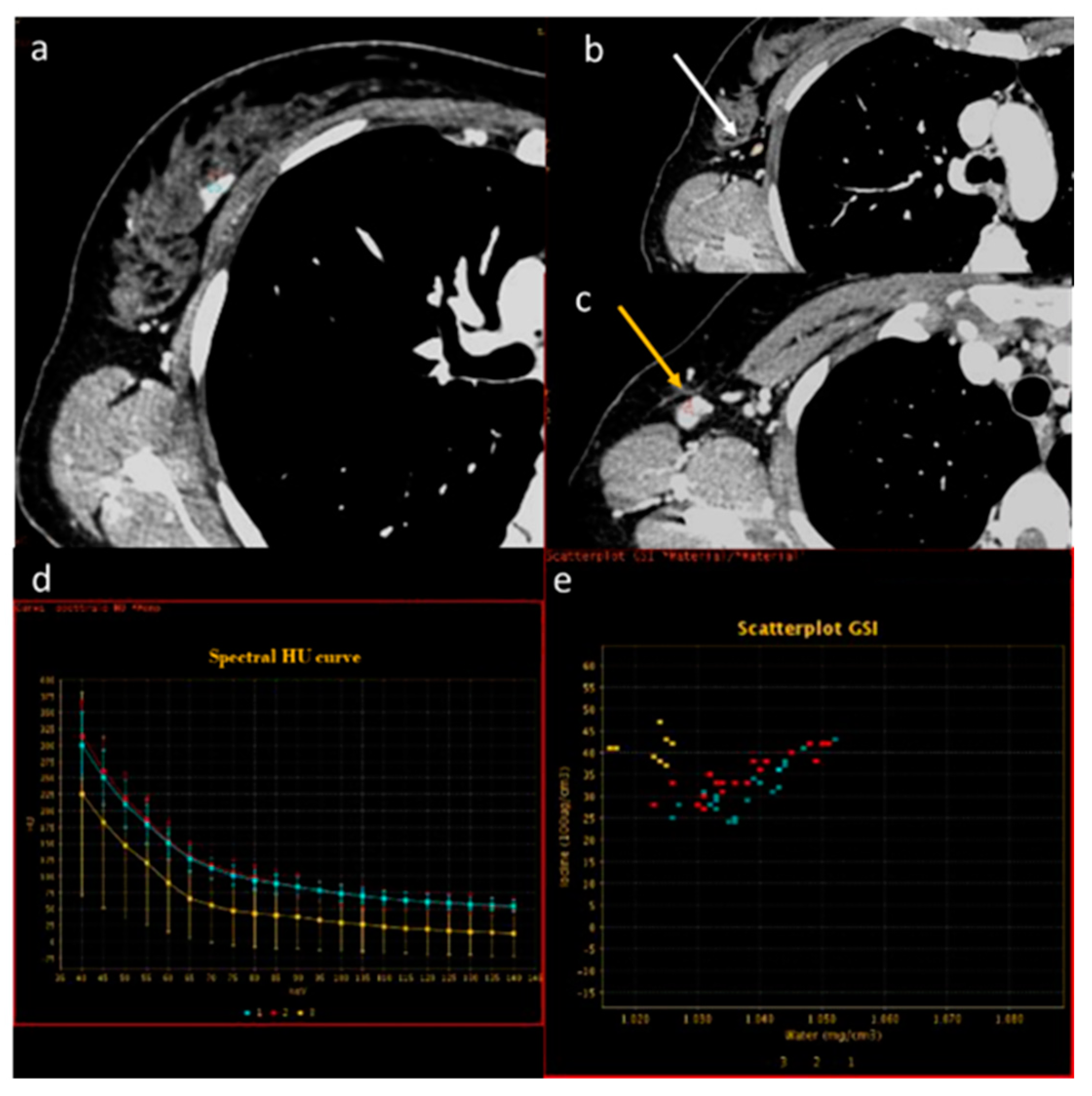 Diagnostics 13 02440 g005