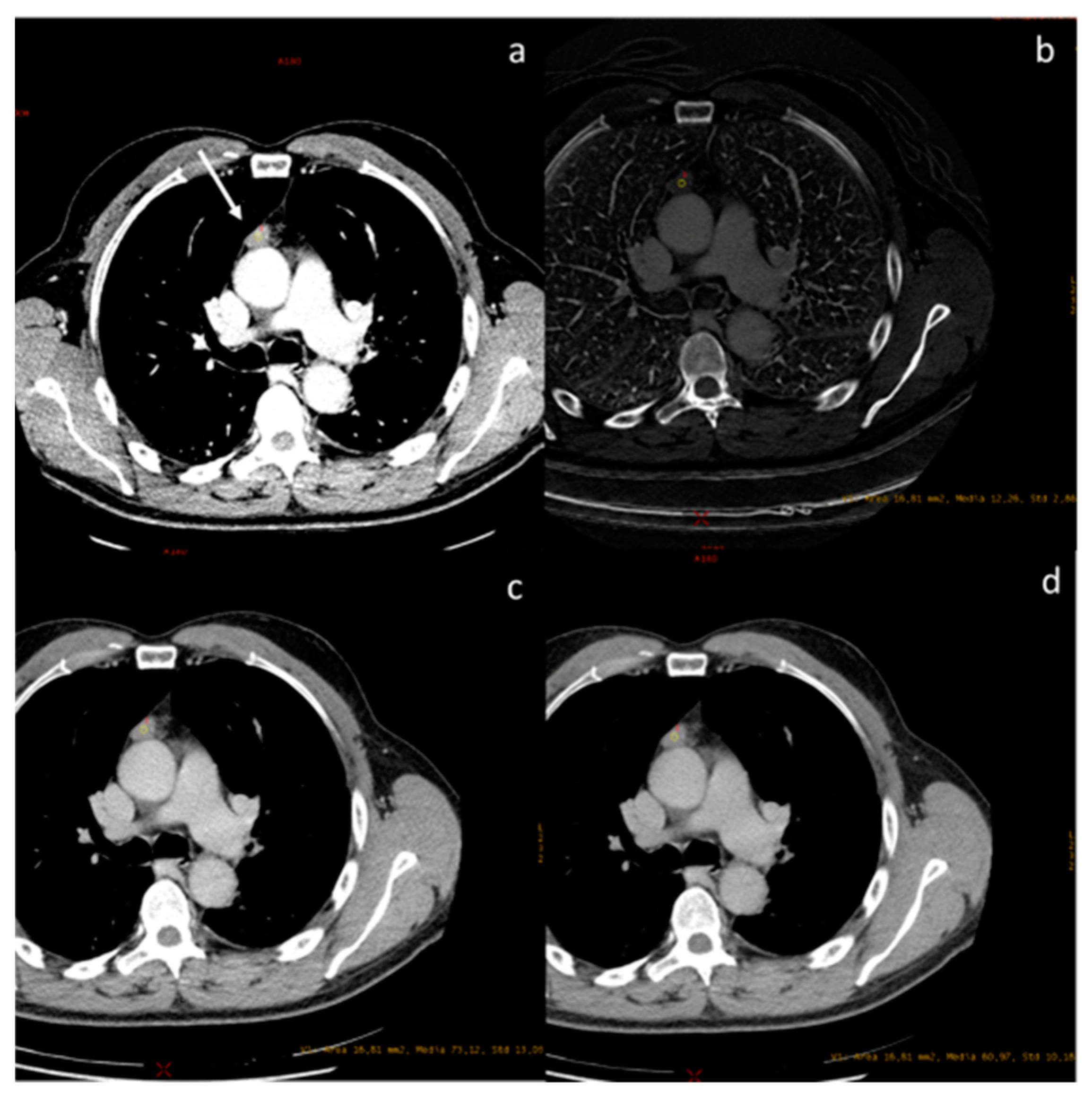 Diagnostics 13 02440 g007