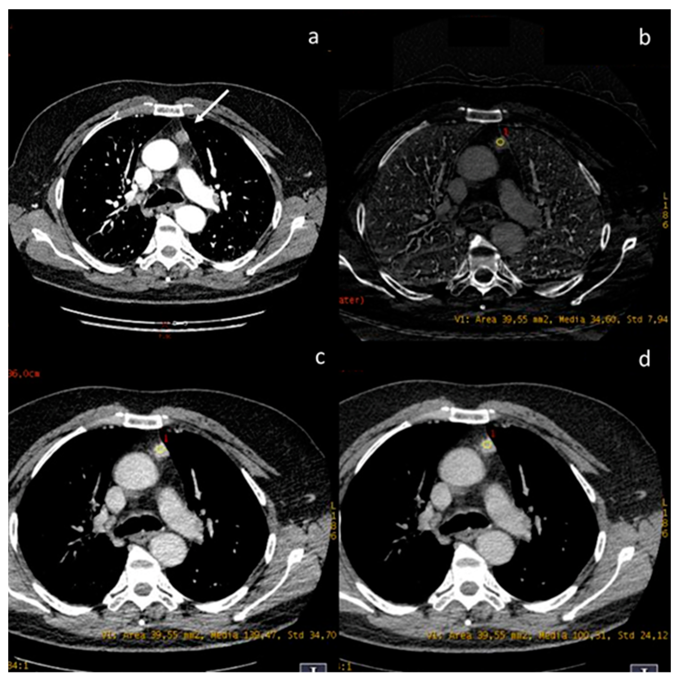Diagnostics 13 02440 g008