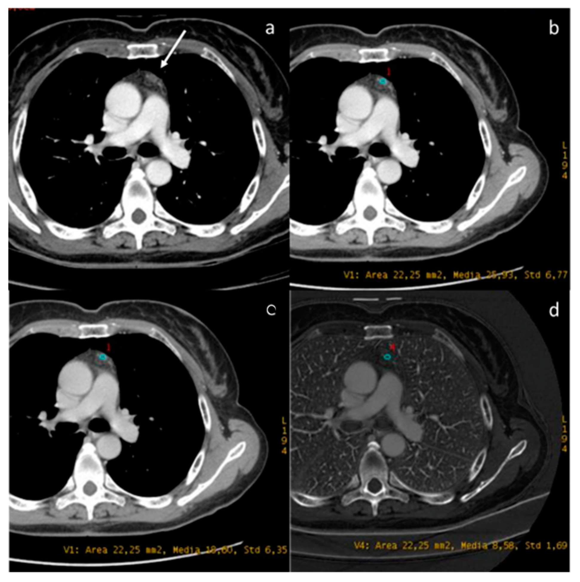 Diagnostics 13 02440 g009