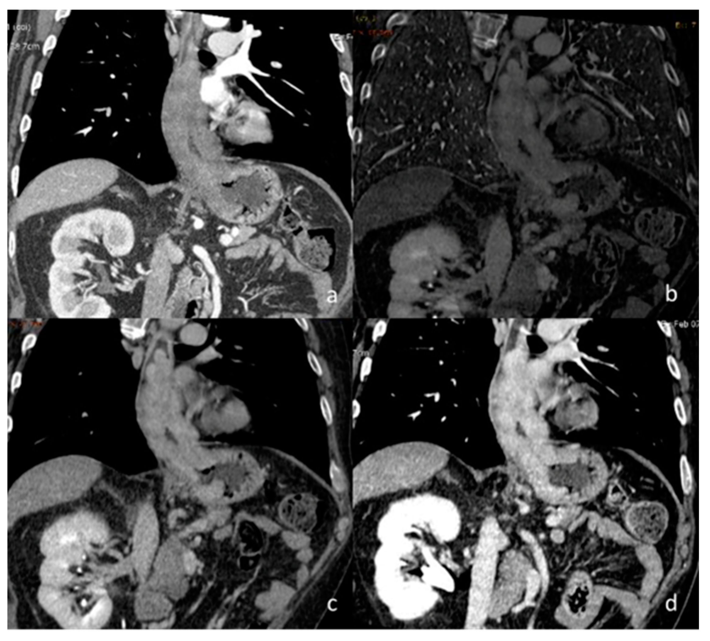 Diagnostics 13 02440 g010