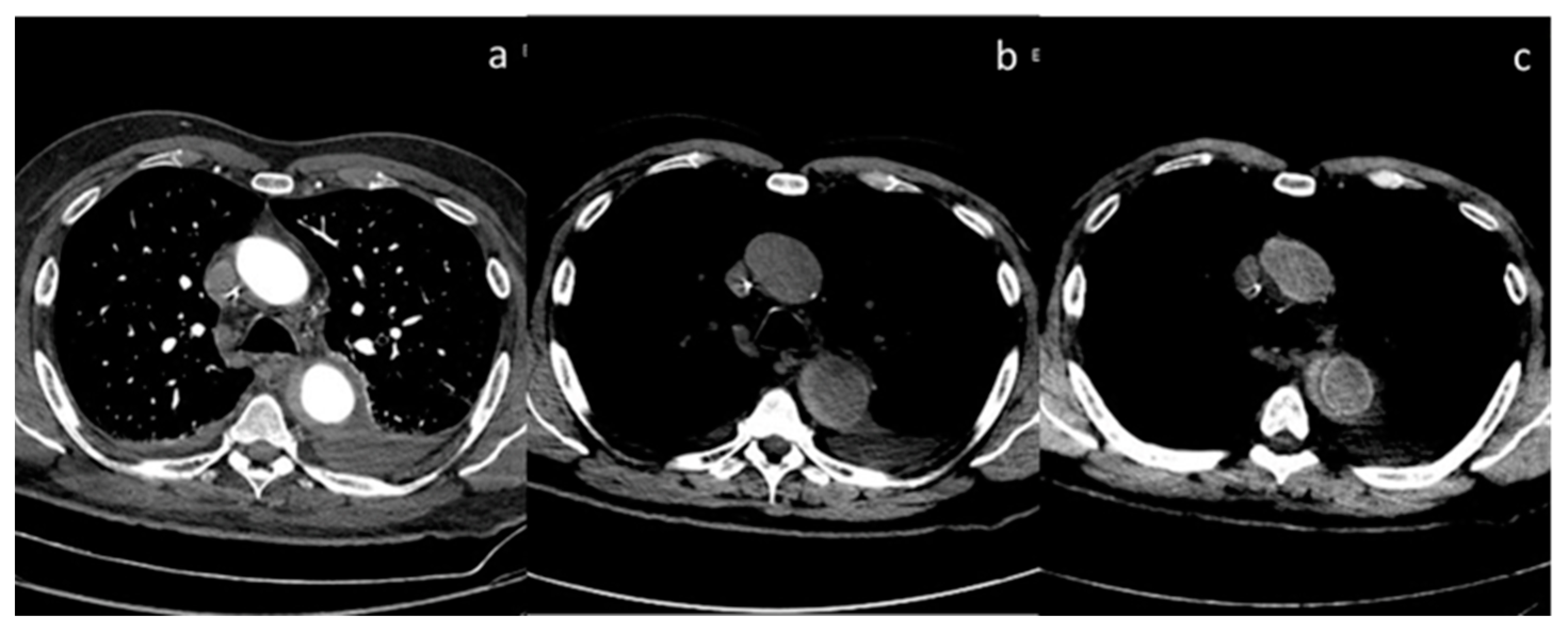 Diagnostics 13 02440 g011