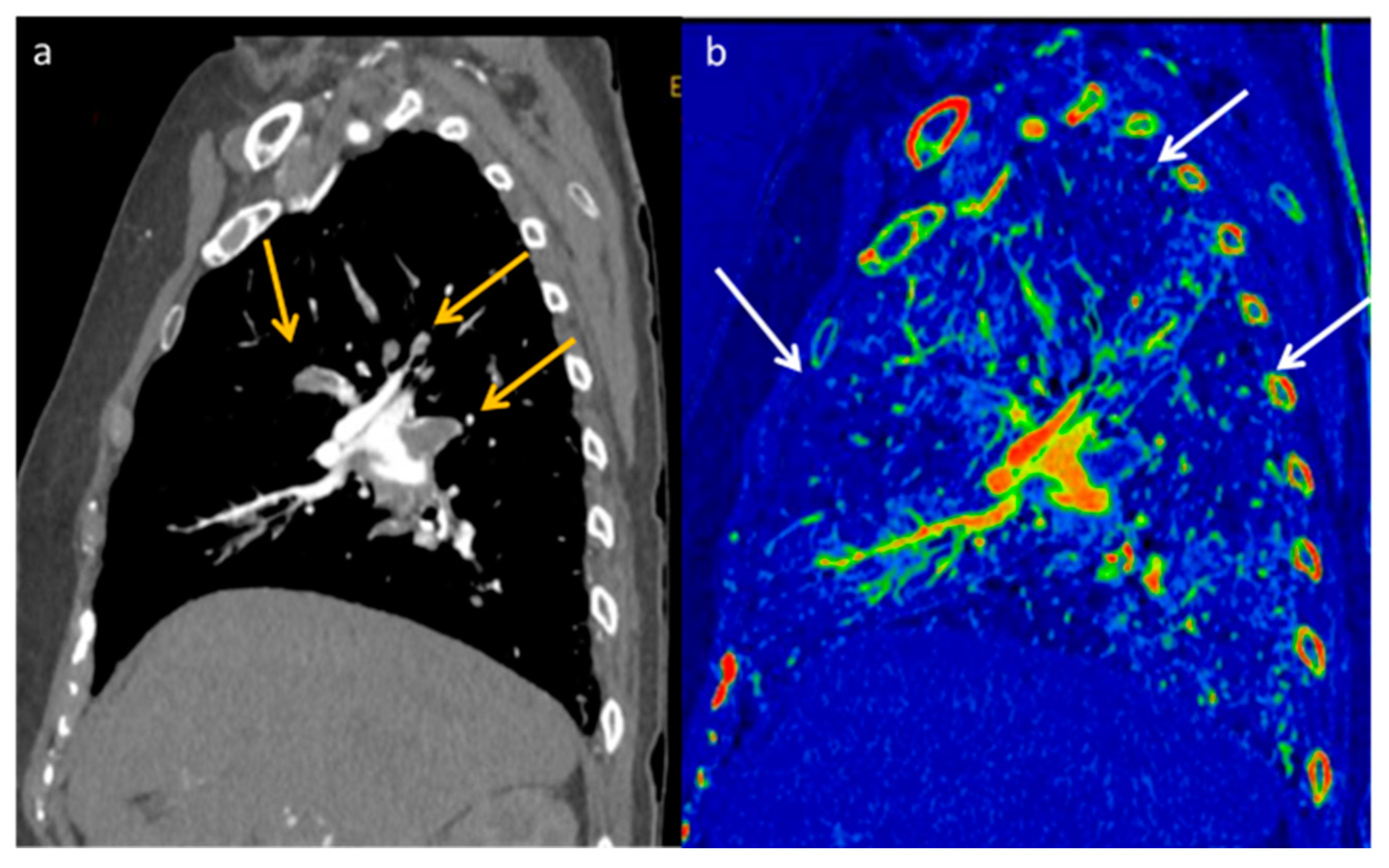 Diagnostics 13 02440 g012
