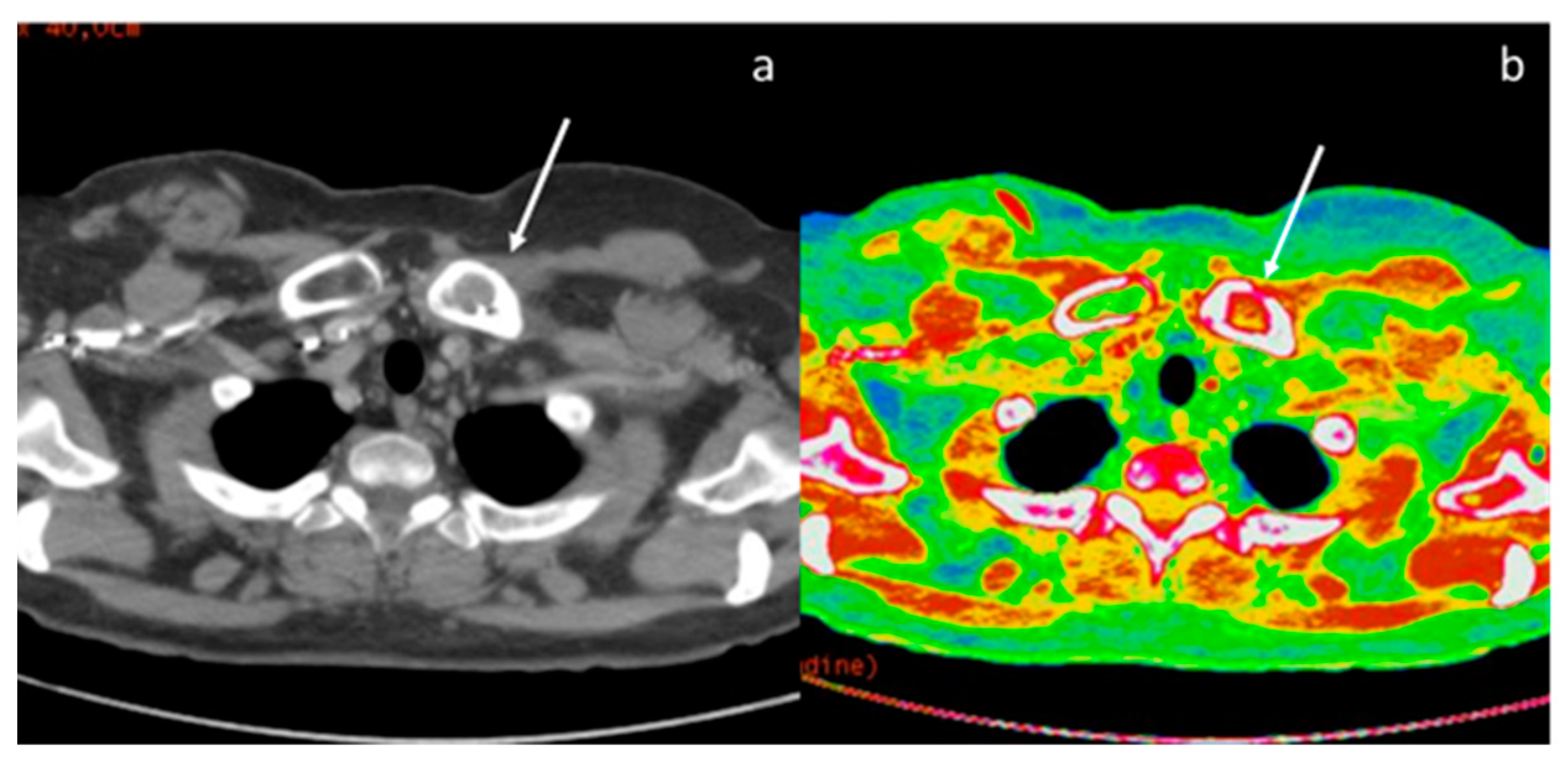 Diagnostics 13 02440 g015