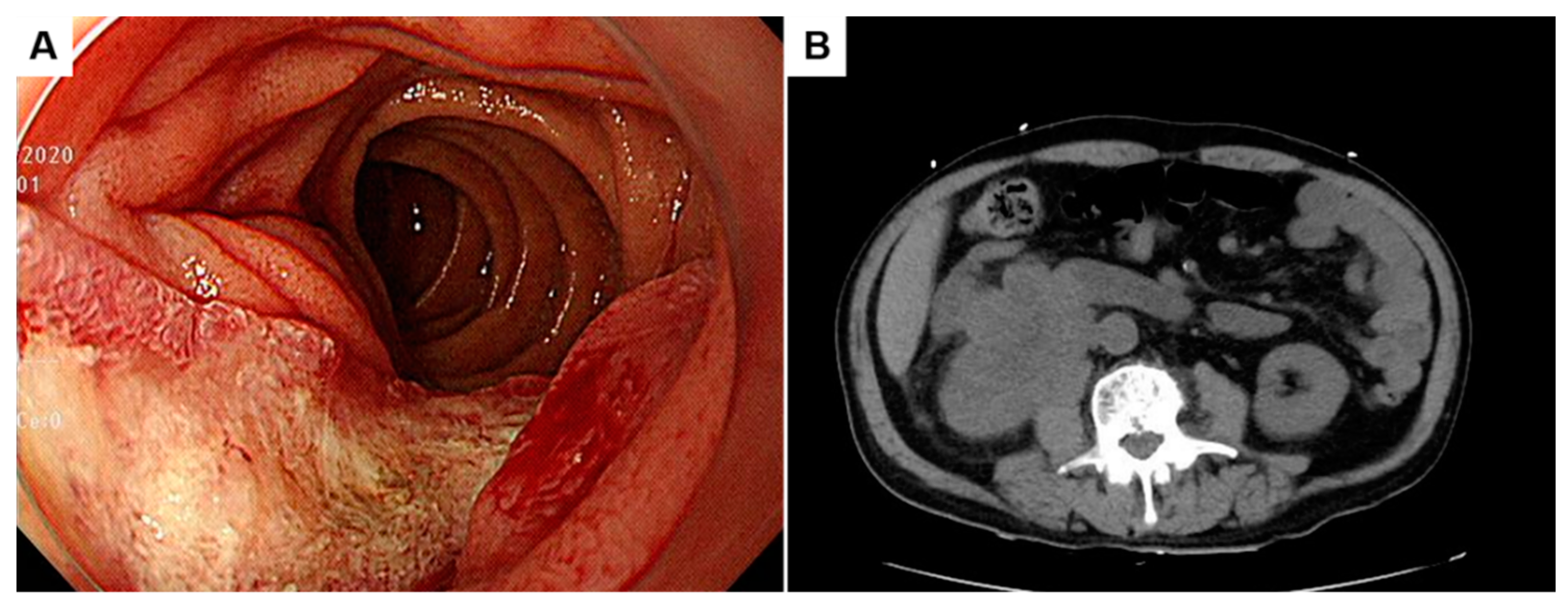 Diagnostics 13 02455 g001