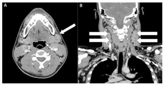 Diagnostics 13 02457 g001
