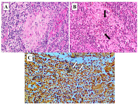Diagnostics 13 02457 g003