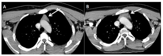 Diagnostics 13 02457 g004