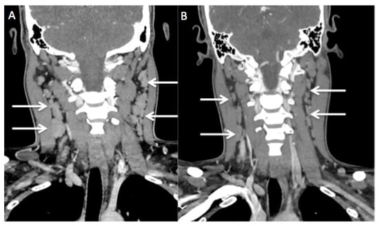 Diagnostics 13 02457 g005