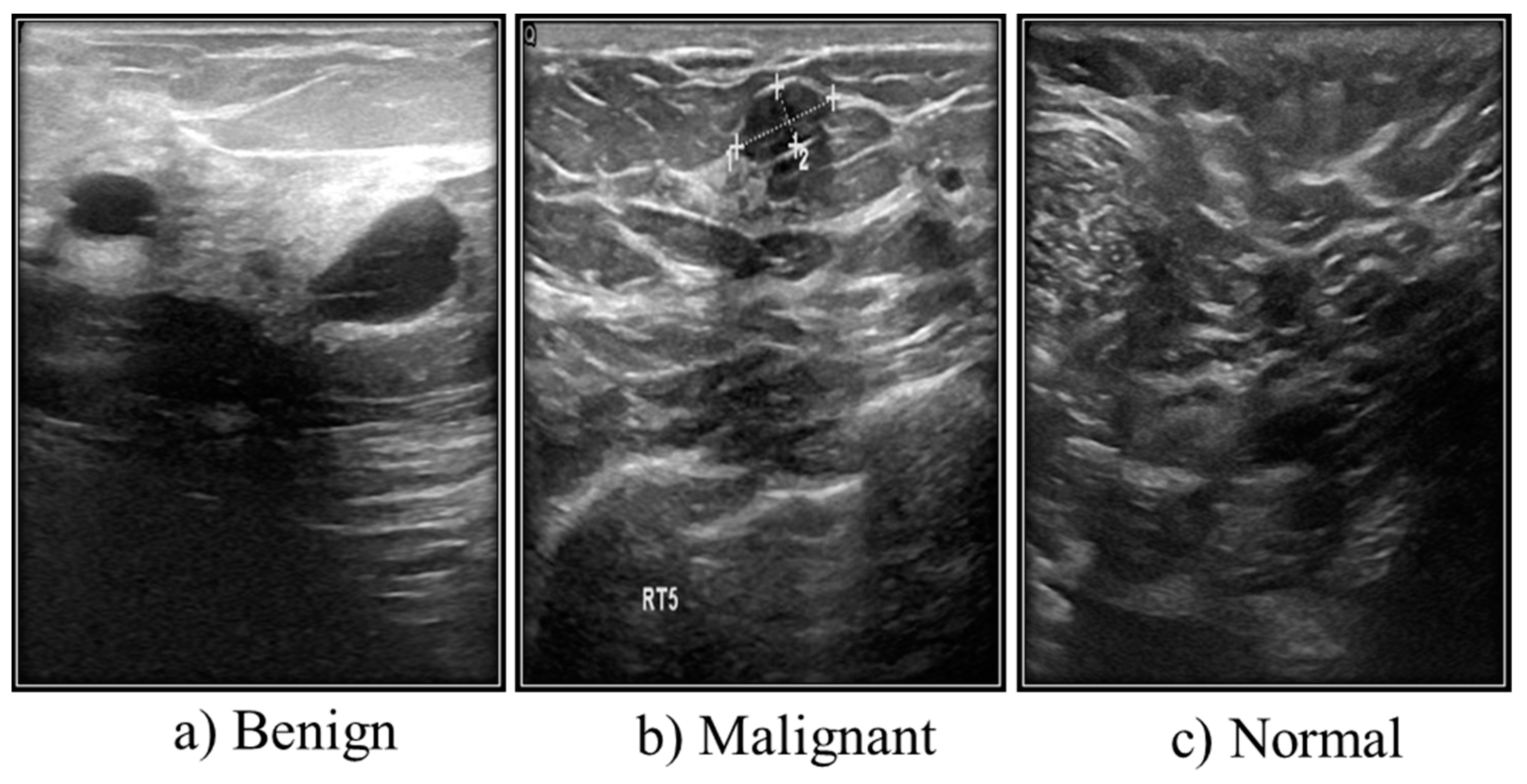 Diagnostics 13 02460 g004