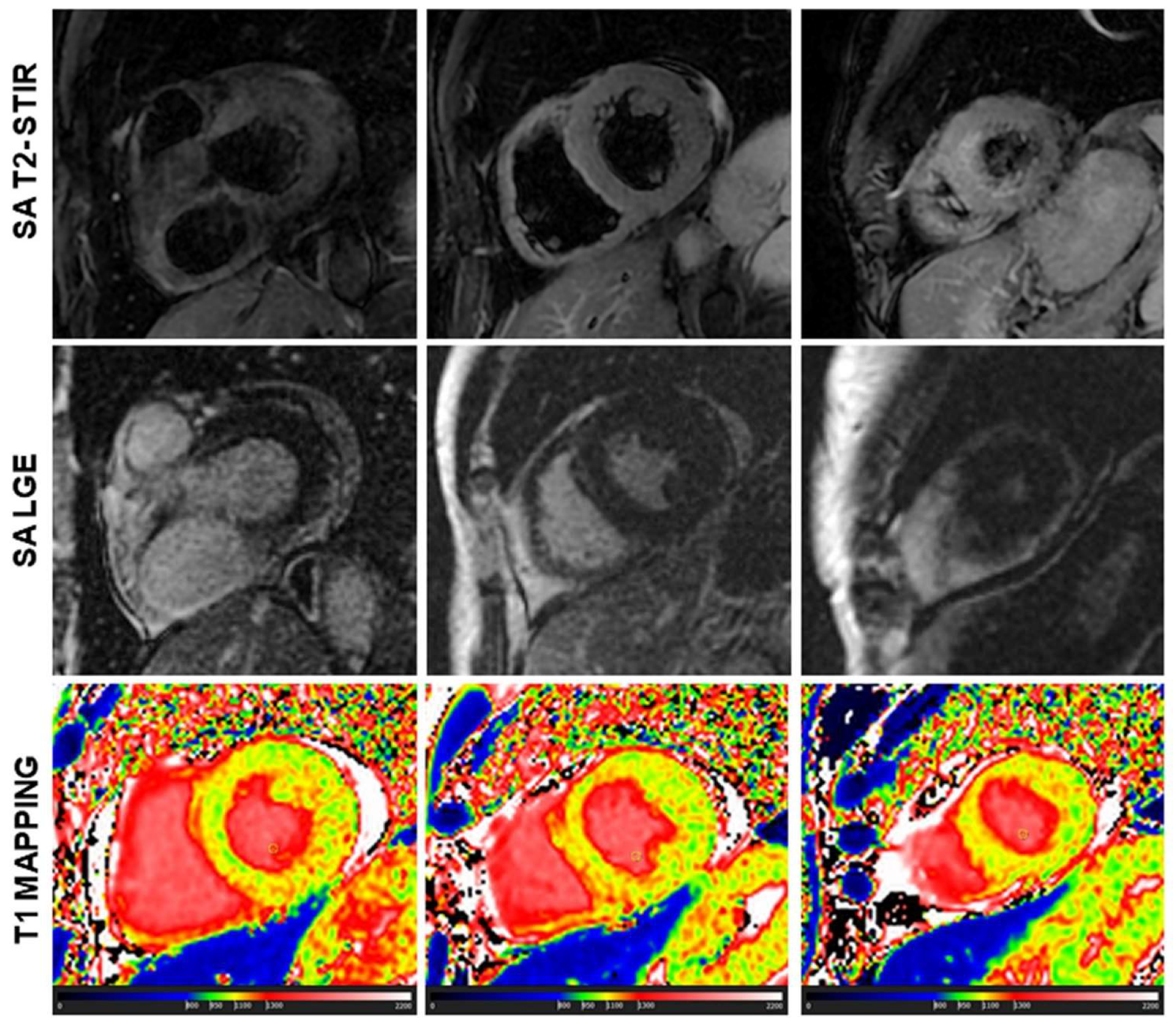 Diagnostics 13 02461 g004 Diagnostics 13 02461 g004