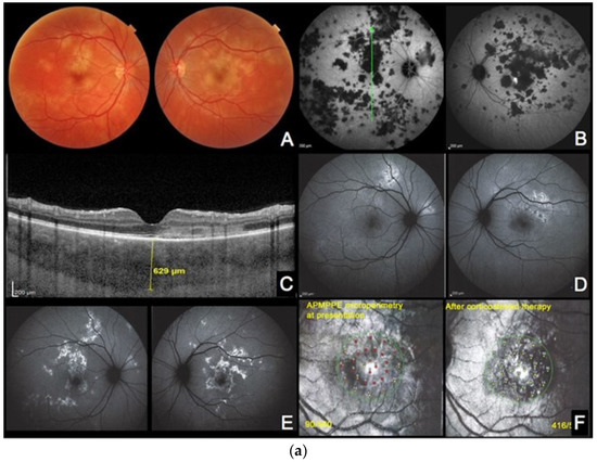 Diagnostics 13 02466 g004a Diagnostics 13 02466 g004a