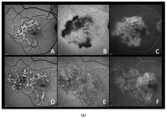 Diagnostics 13 02466 g005a Diagnostics 13 02466 g005a