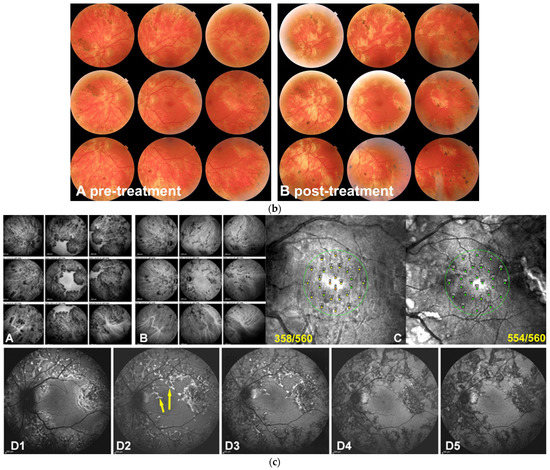 Diagnostics 13 02466 g005b