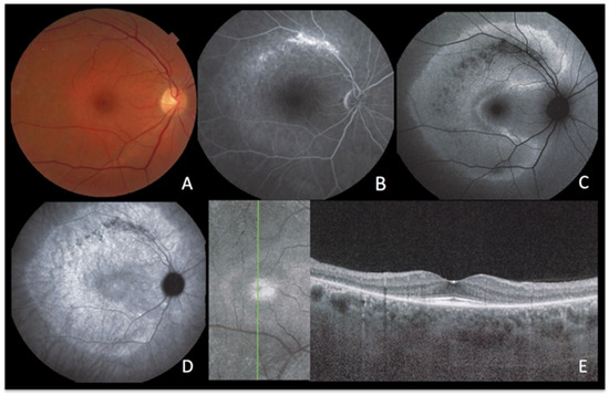 Diagnostics 13 02466 g007