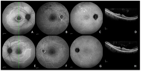 Diagnostics 13 02466 g008