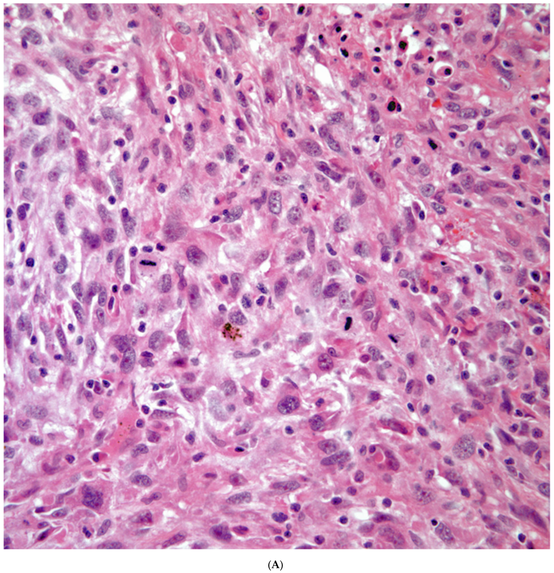 Diagnostics 13 02477 g002a