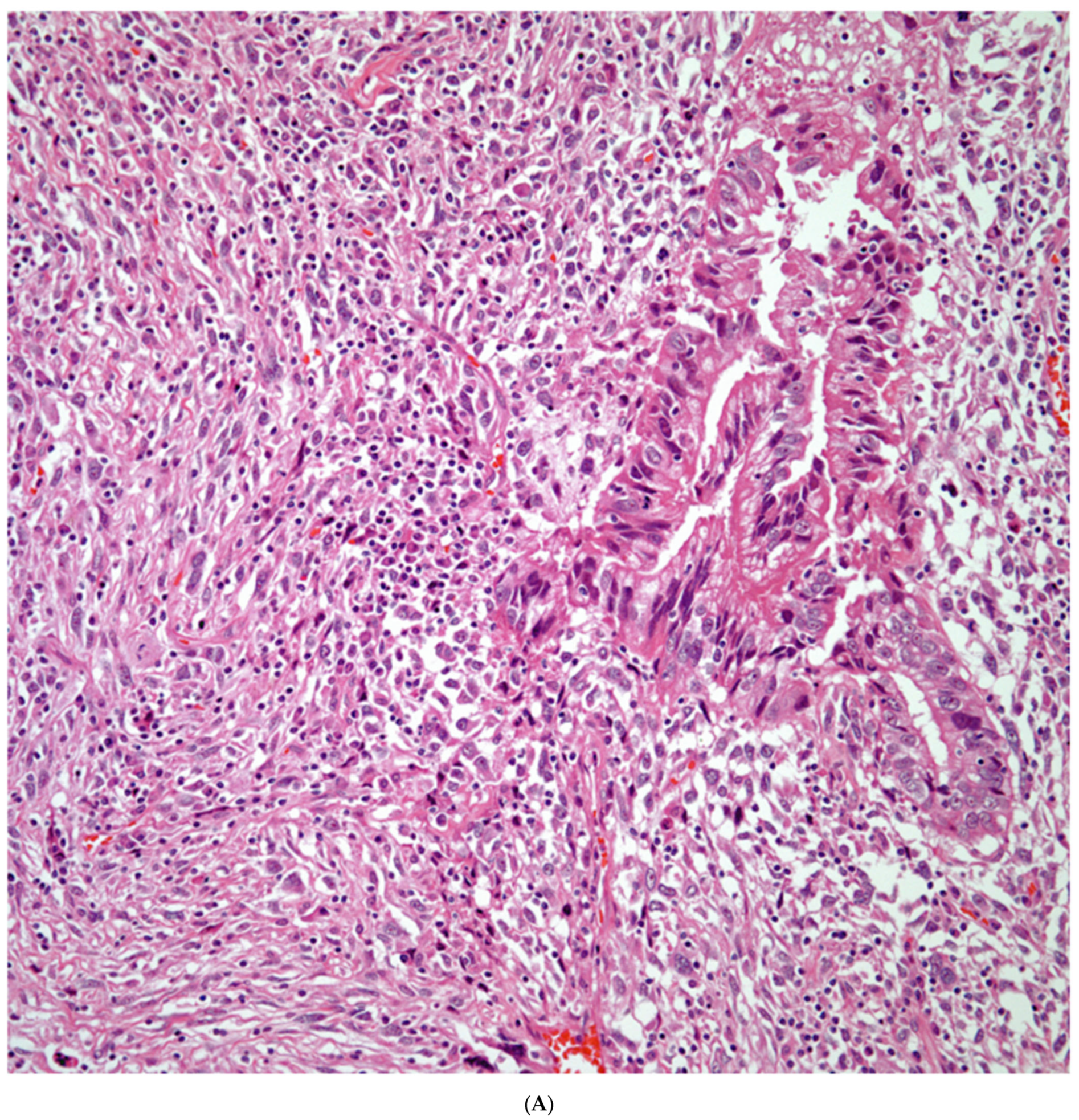 Diagnostics 13 02477 g003a