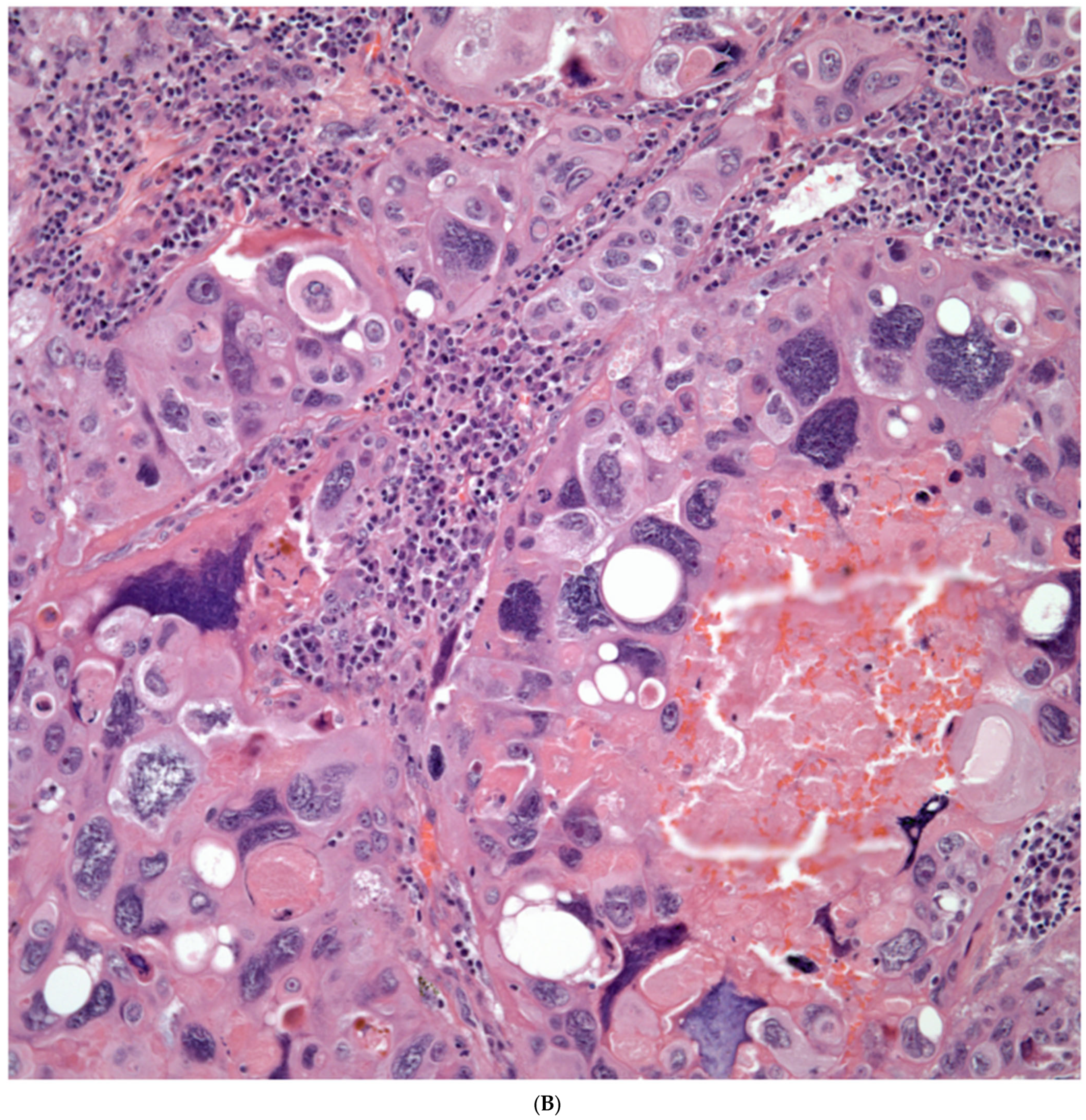 Diagnostics 13 02477 g005b