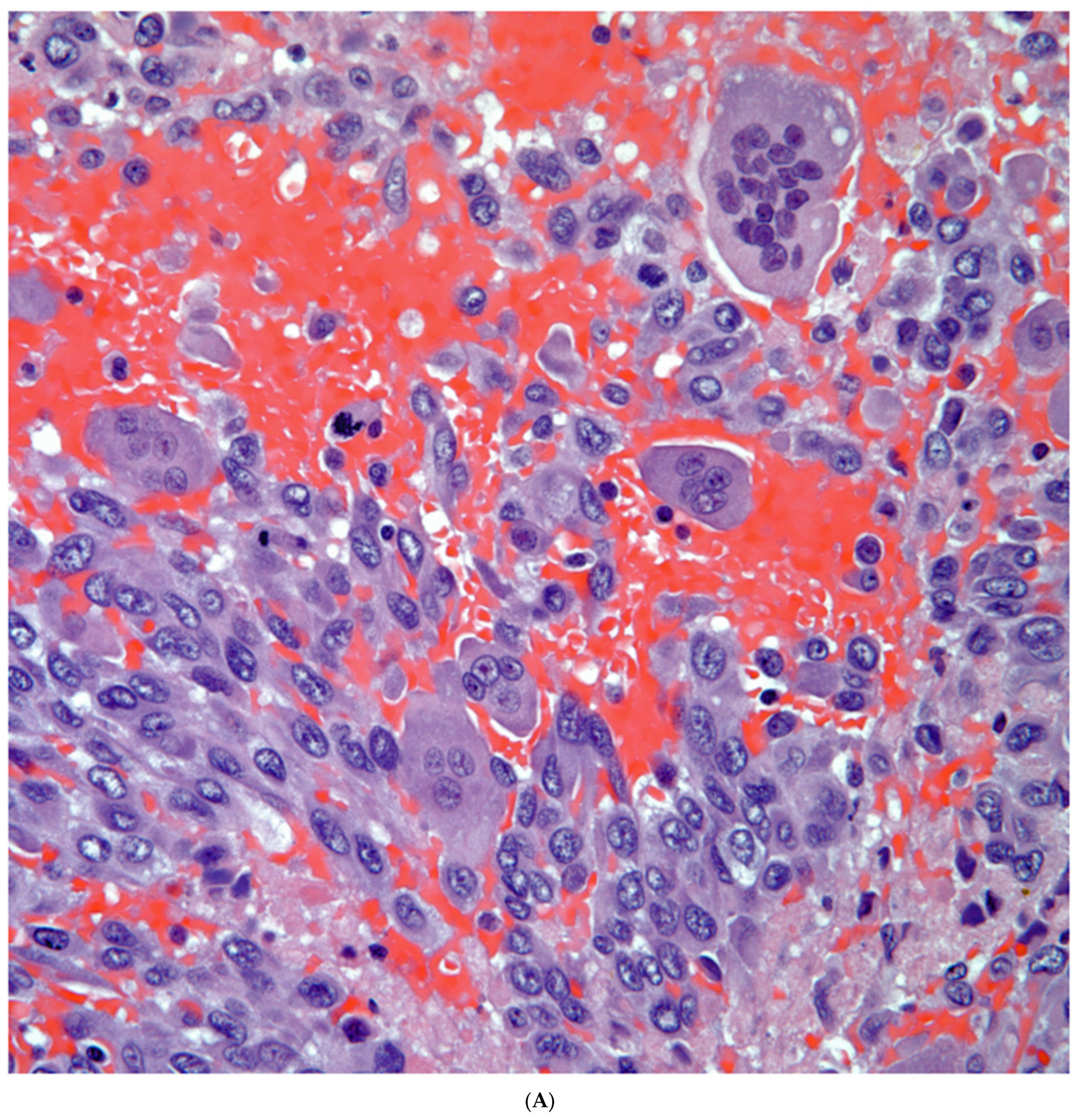 Diagnostics 13 02477 g007a