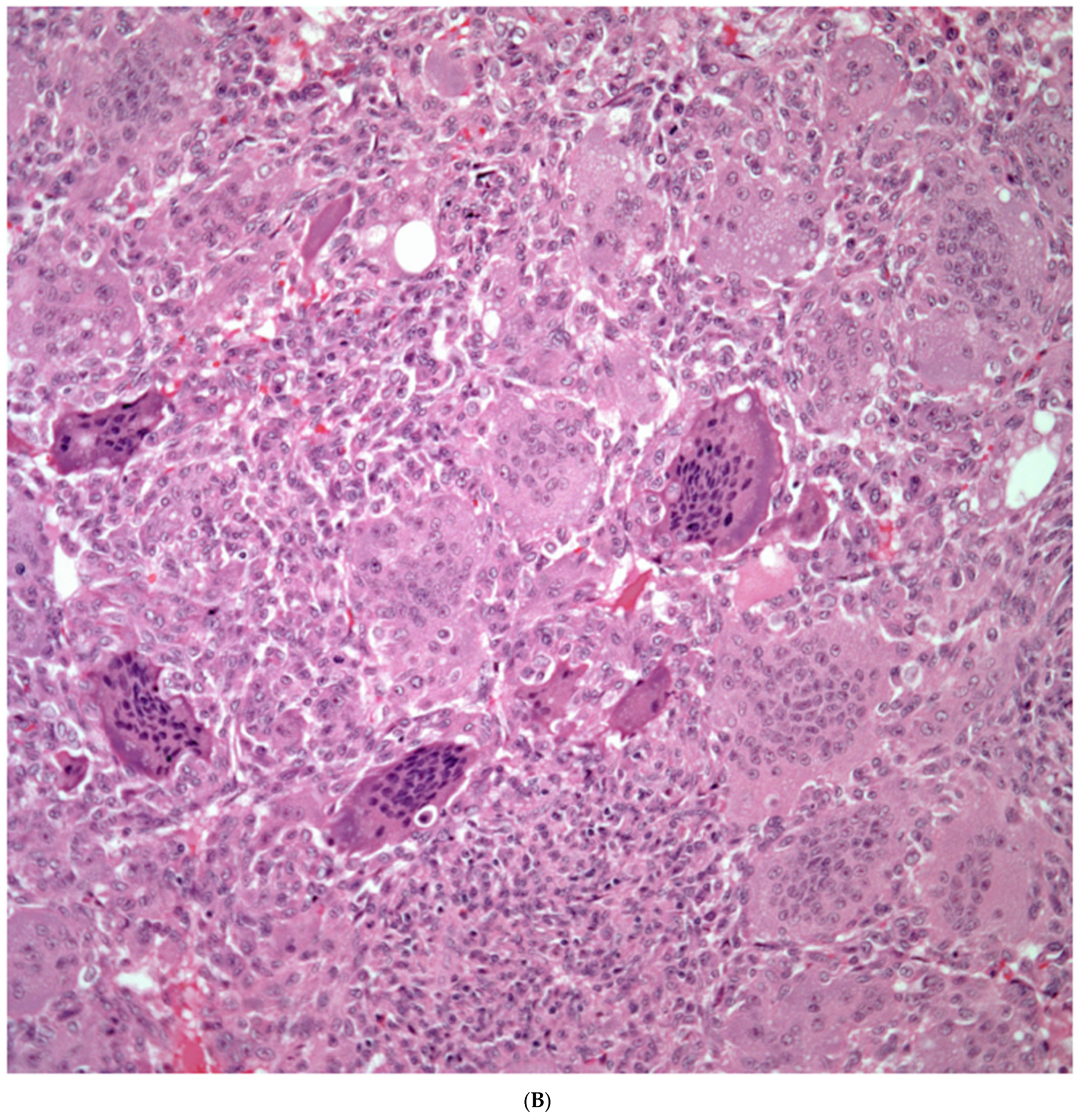 Diagnostics 13 02477 g007b