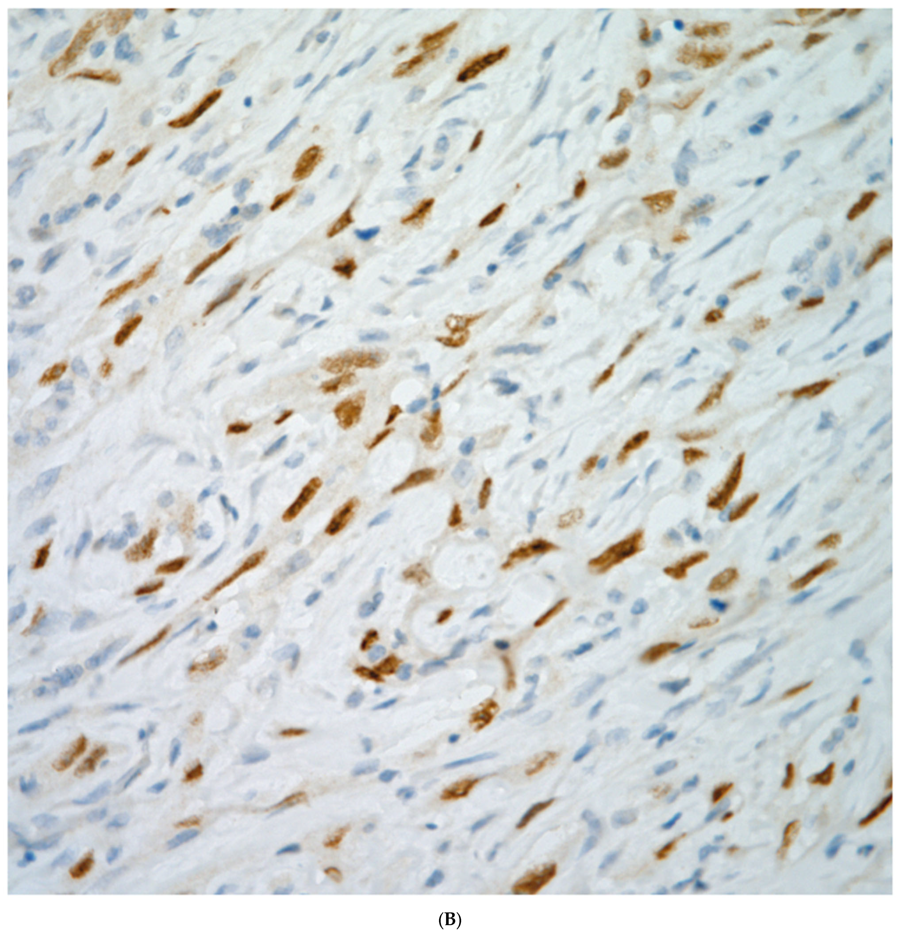 Diagnostics 13 02477 g008b