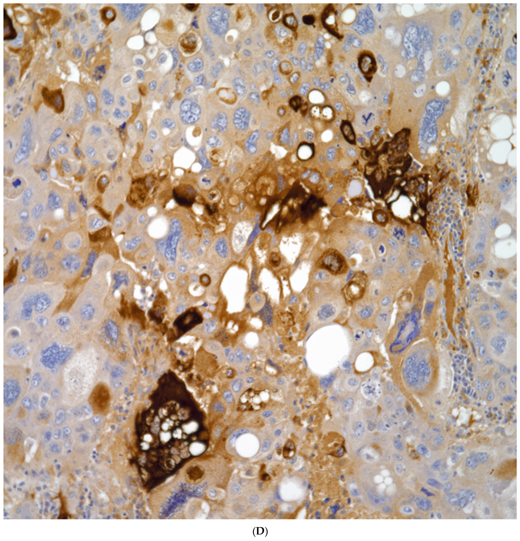 Diagnostics 13 02477 g008d