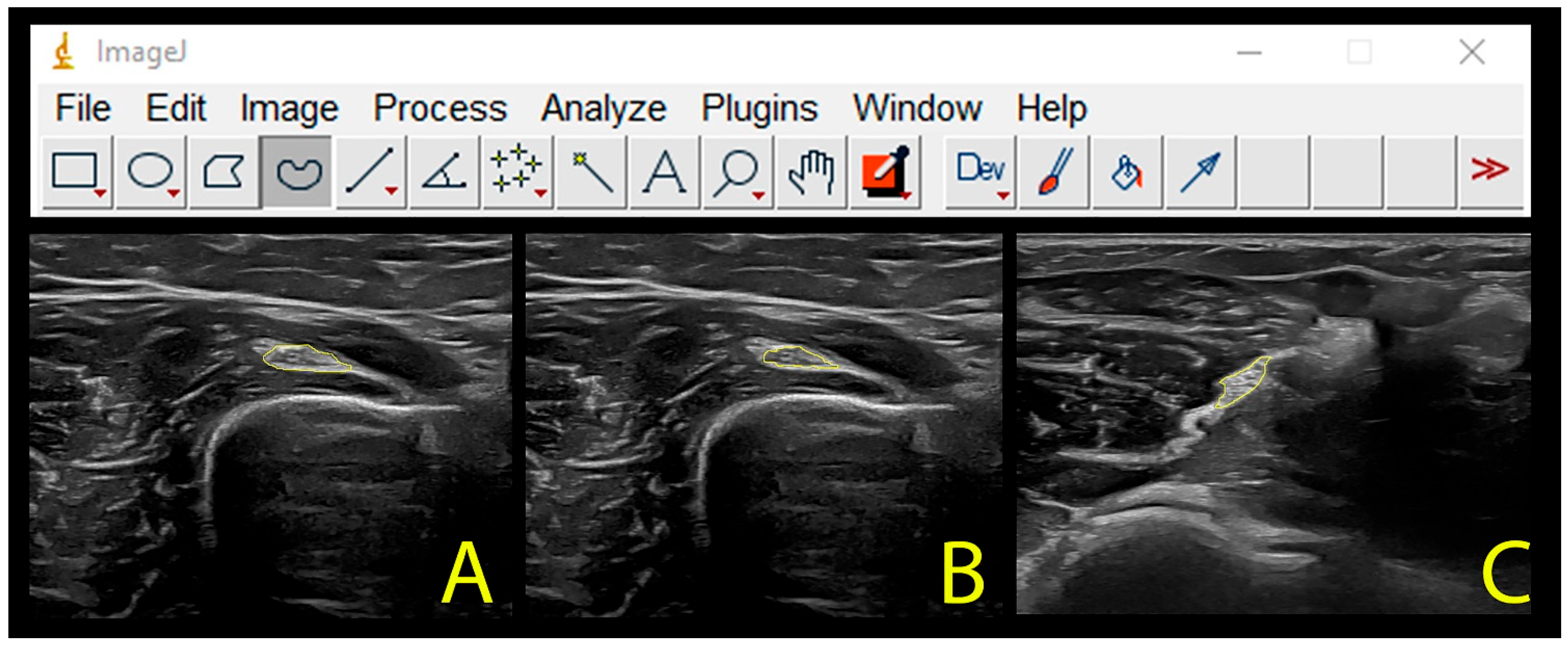 Diagnostics 13 02488 g004