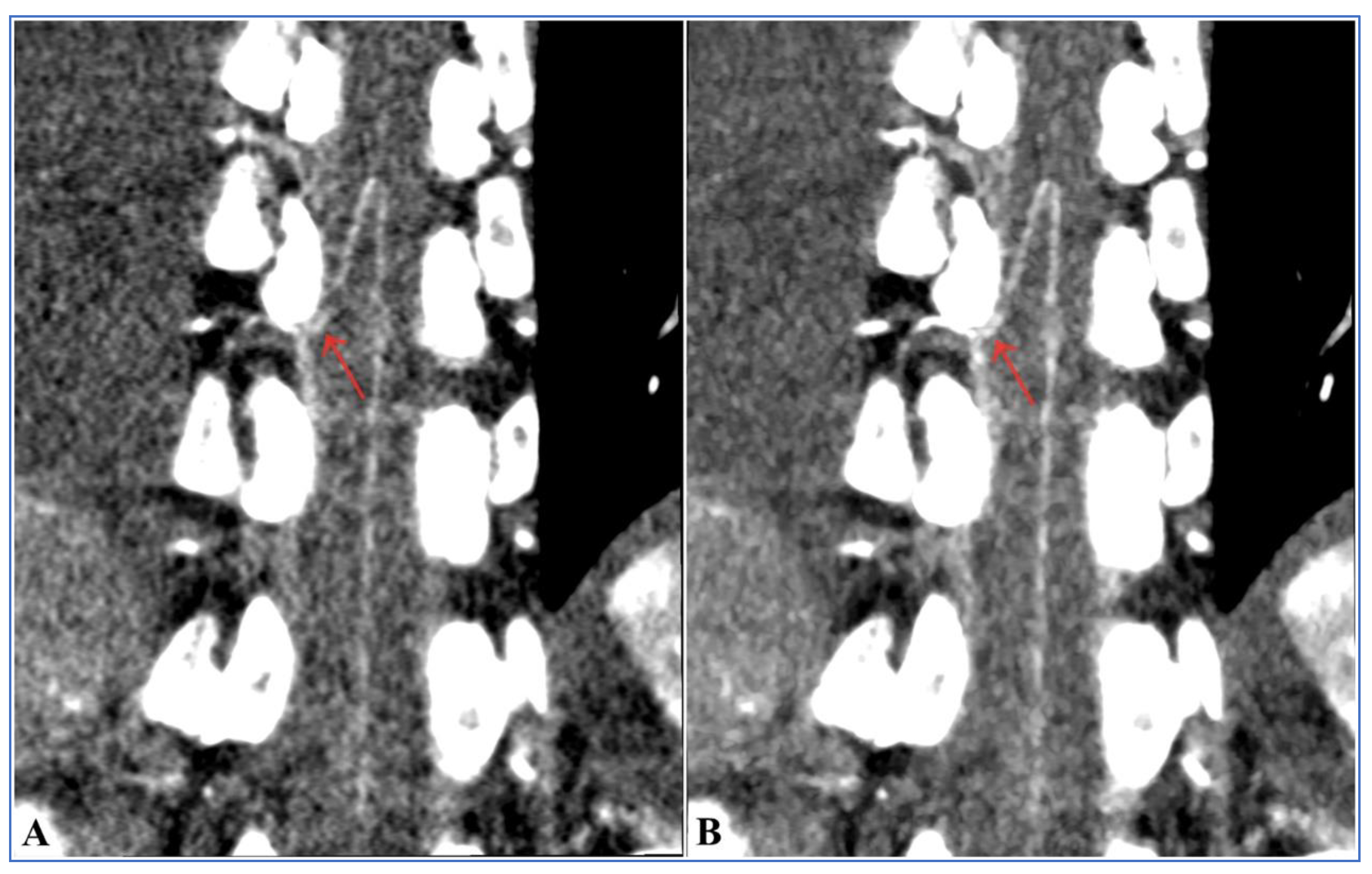 Diagnostics 13 02495 g008