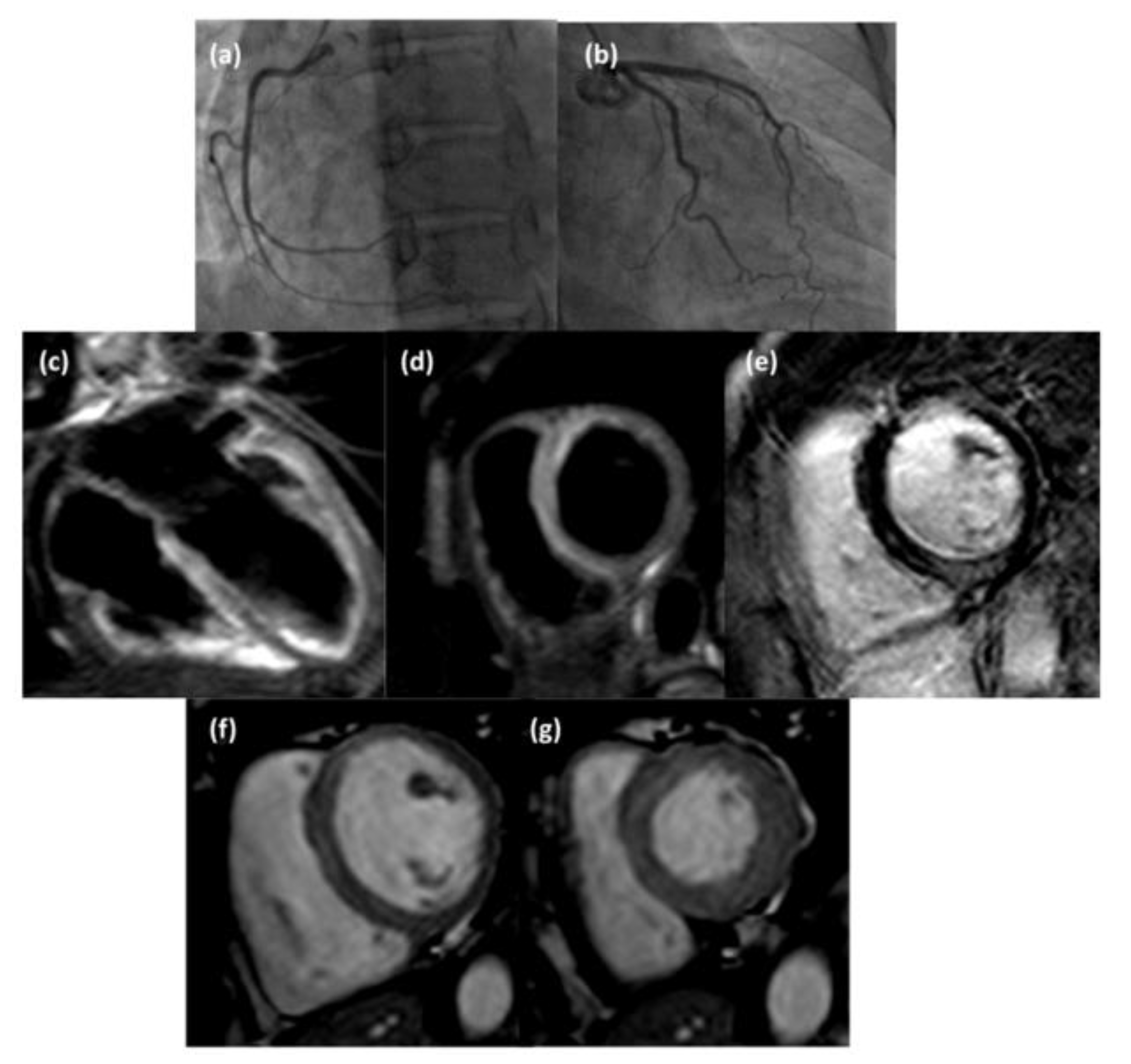 Diagnostics 13 02498 g004 Diagnostics 13 02498 g004