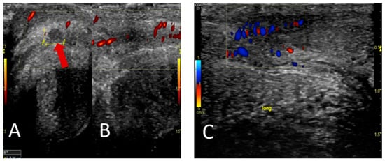 Diagnostics 13 02509 g001