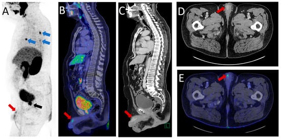 Diagnostics 13 02509 g002